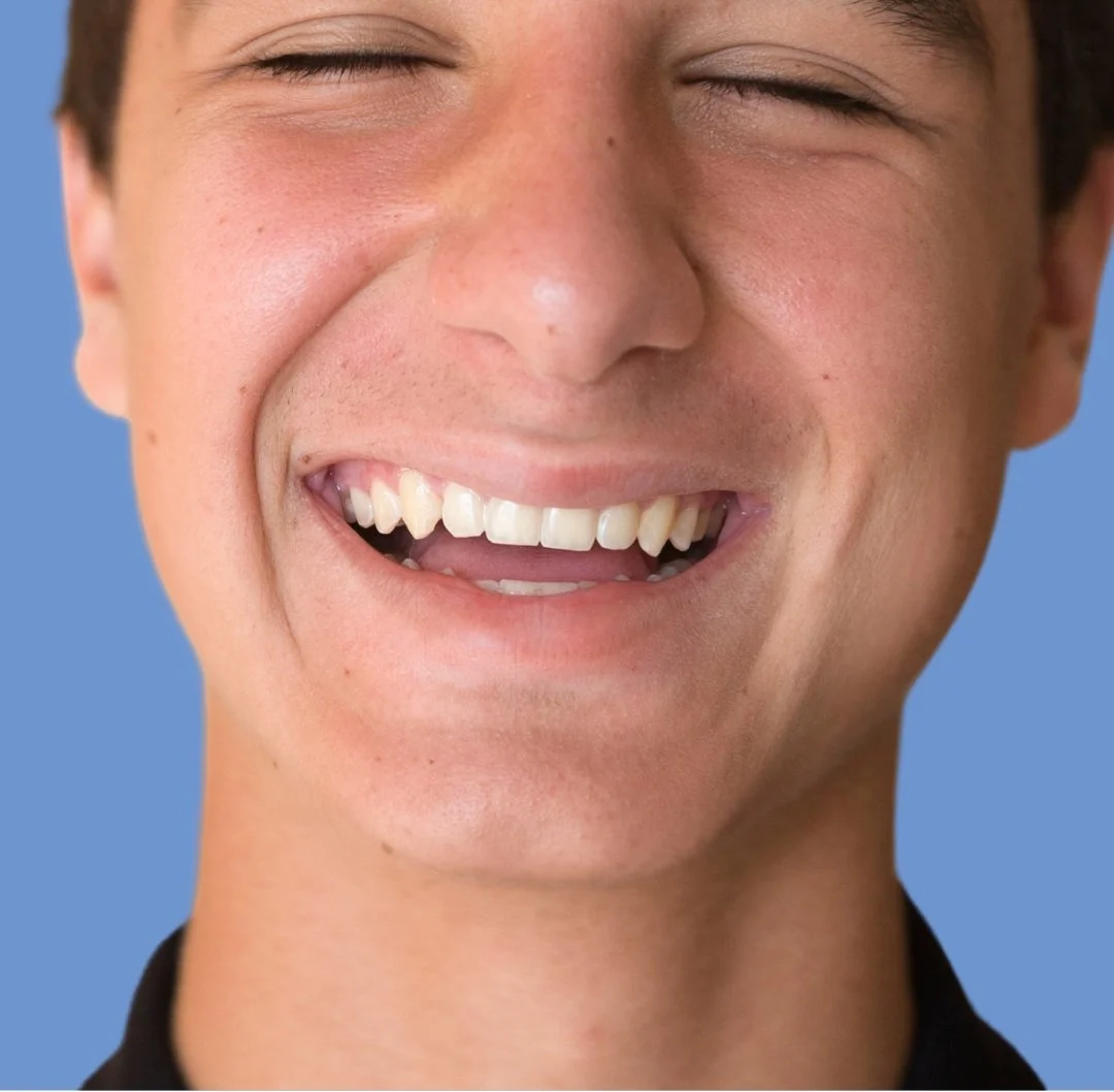 การดูแลหลังผ่าฟันคุด เชียงใหม่ | post-operative care after wisdom tooth removal chiangmai