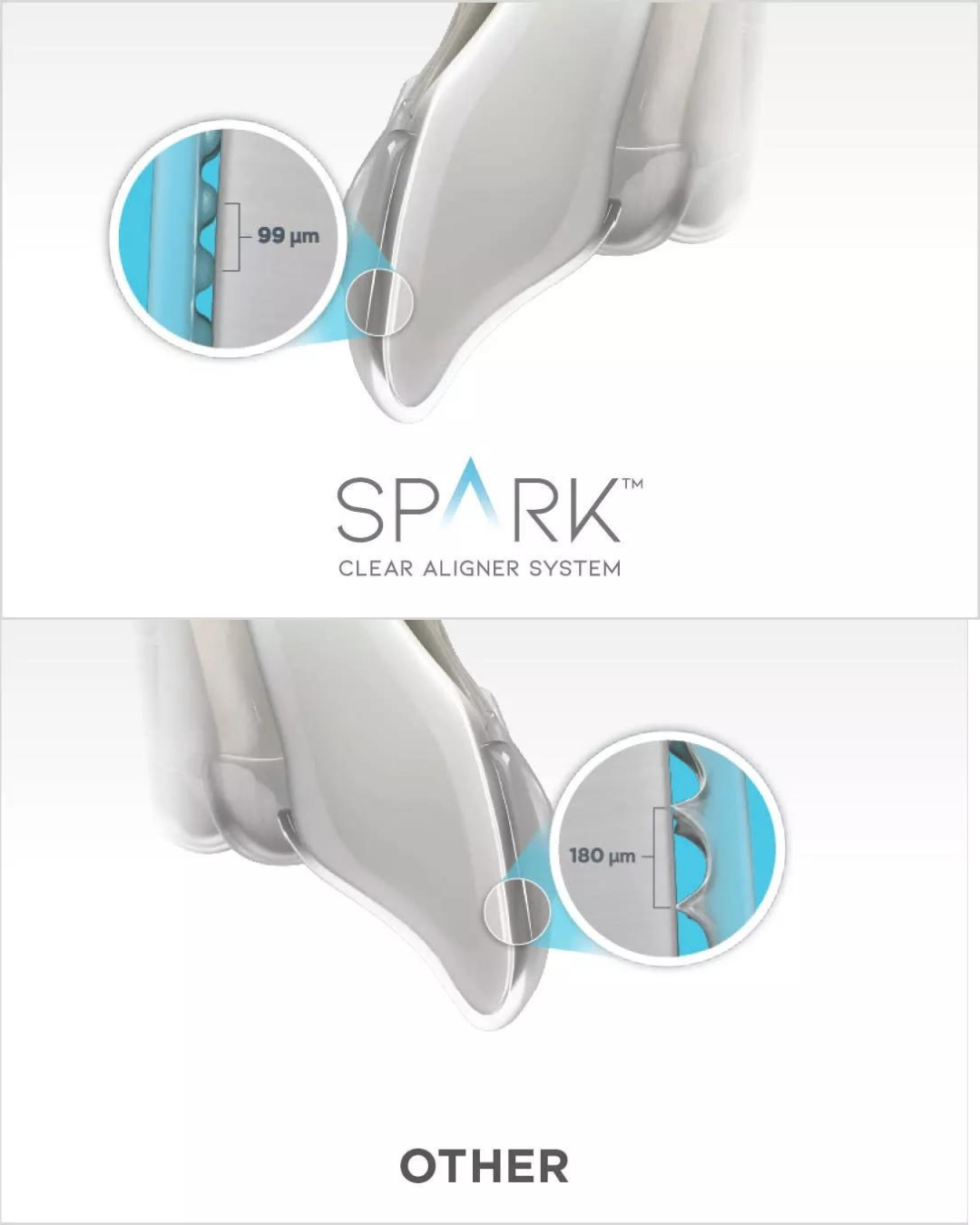 spark aligners TruGEN™ closeup chiangmai