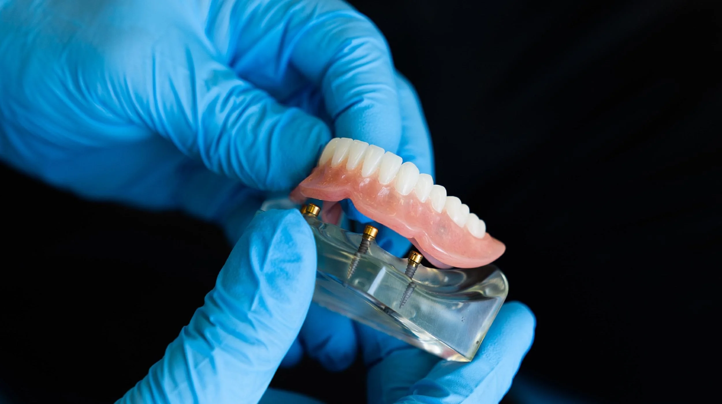 A complete financial guide to All-on-X dental implants in 2026, featuring a person with a bright, healthy smile after treatment.  2