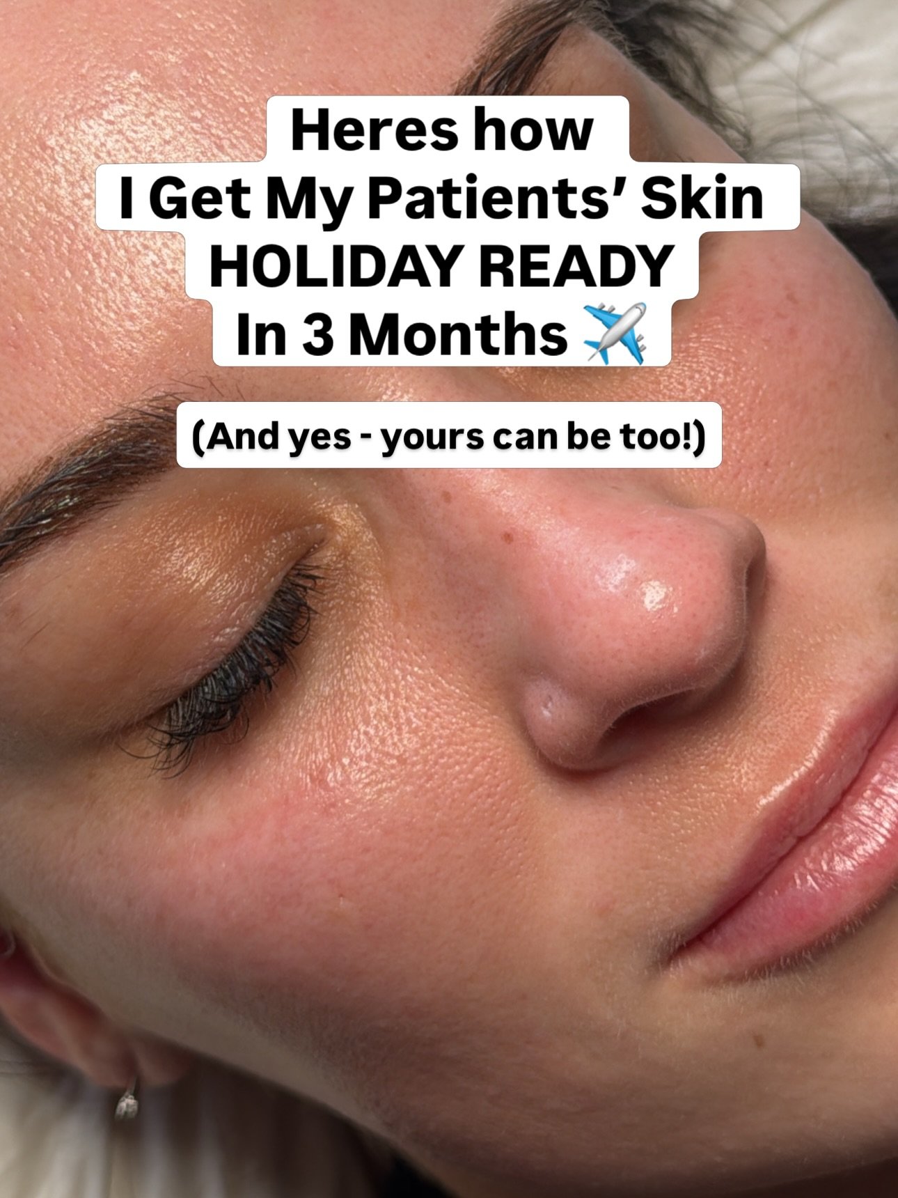 Getting &ldquo;holiday OR wedding ready&rdquo; is not about last-minute appointments. 

It&rsquo;s about bespoke strategic planning with a specialist who can work it all out for you and give you the end result that you want but are not quite sure how