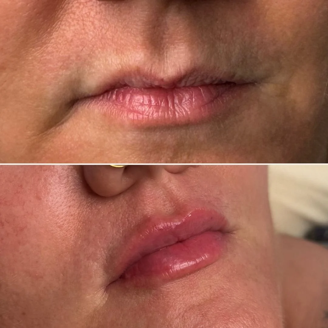 lips 6.jpg