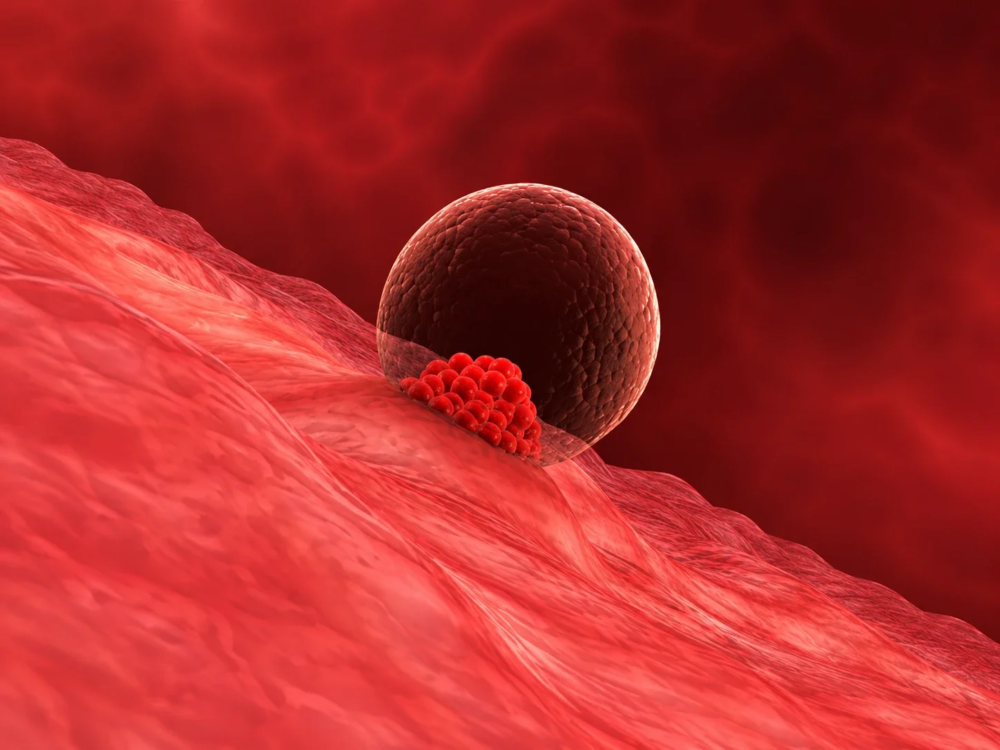 Red Light Therapy and Implantation