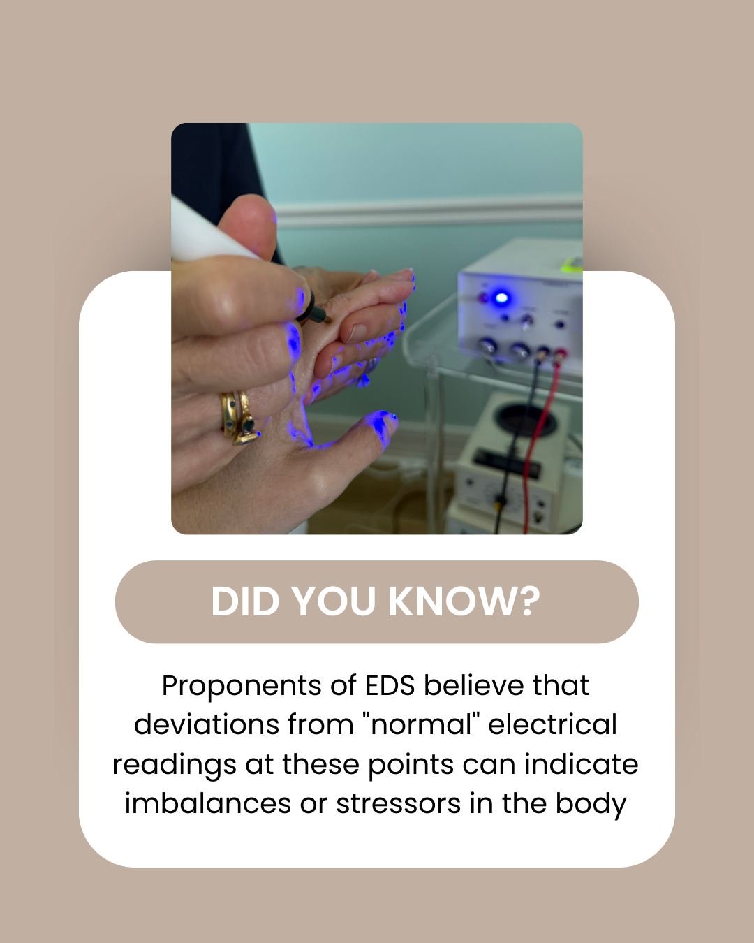 🔬✨ What Is Your Energy Trying to Tell You?
Proponents of Electrodermal Screening (EDS) believe that when your body shows electrical deviations at specific acupuncture points, it's a sign of stress or imbalance, long before symptoms show up. These i