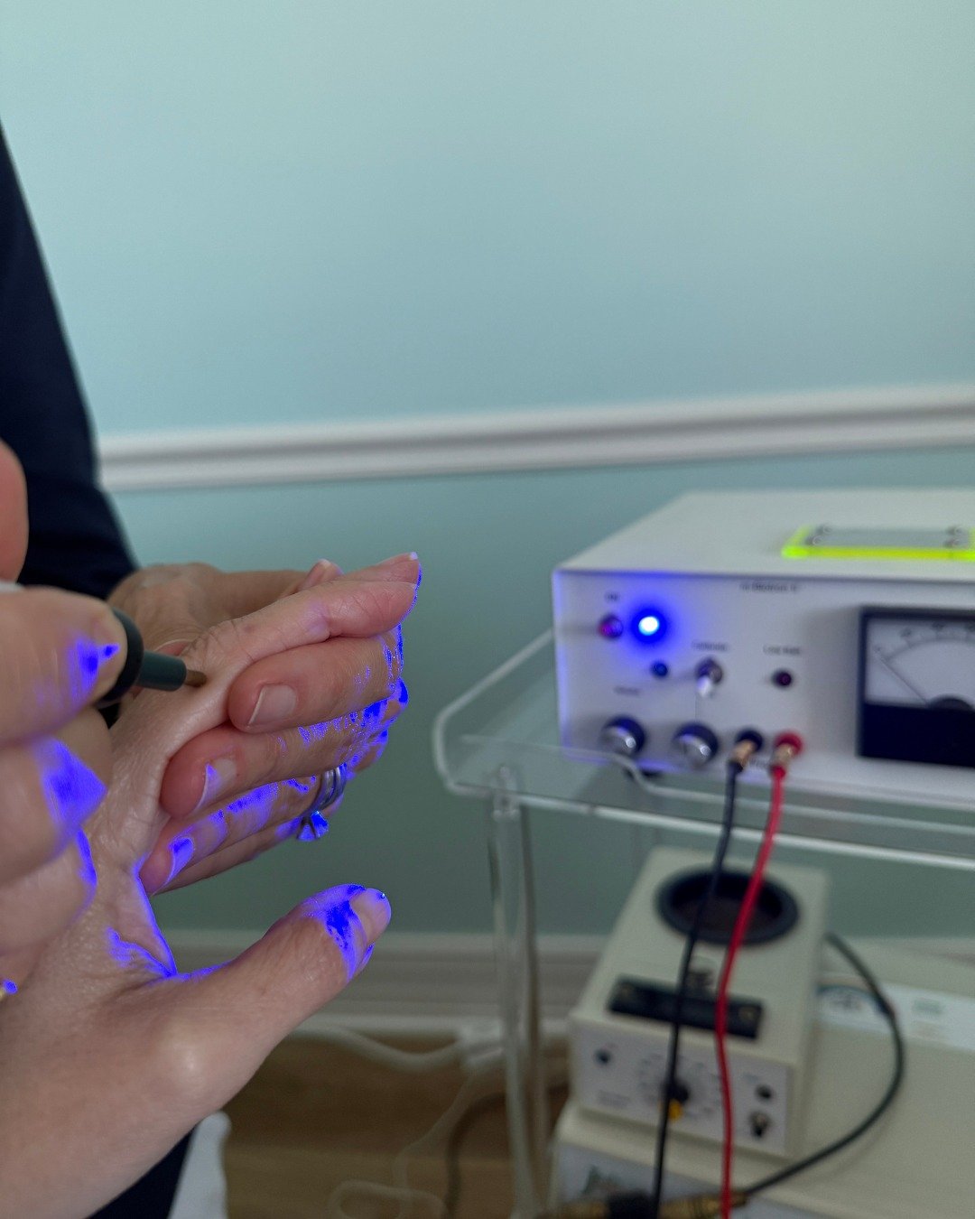 🔬✨ How Does Electrodermal Screening (EDS) Work?
Your body is made up of energetic pathways—much like highways of communication between your organs, glands, and systems. Electrodermal Screening works by measuring the electrical conductivity at