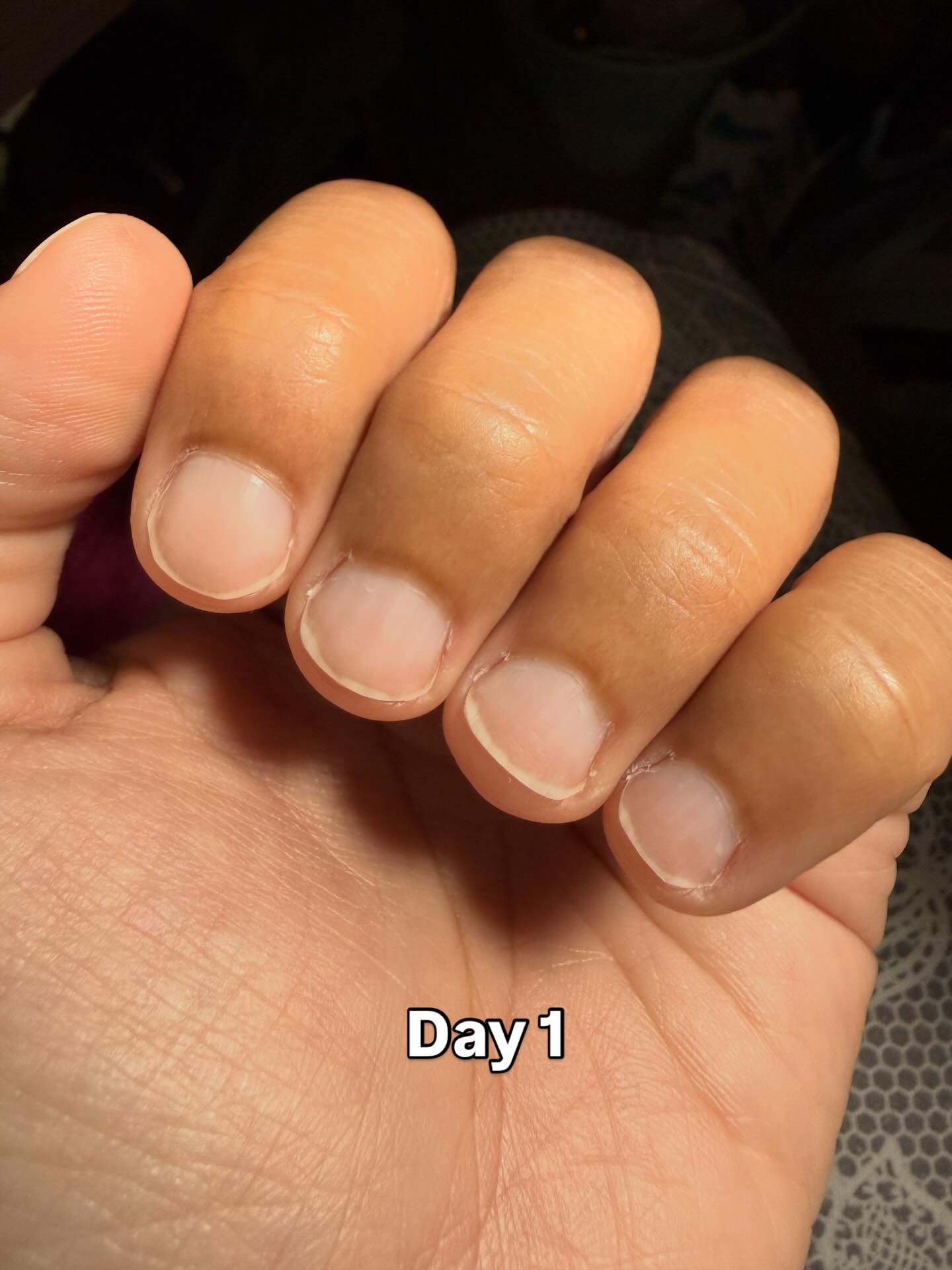 Day 5 of the BVC Learn Something New Challenge

Let&rsquo;s talk about collagen &mdash; because this is one of the most overlooked nutrients when it comes to healthy aging.

Starting in our mid-20s, our natural collagen production begins to decline. 