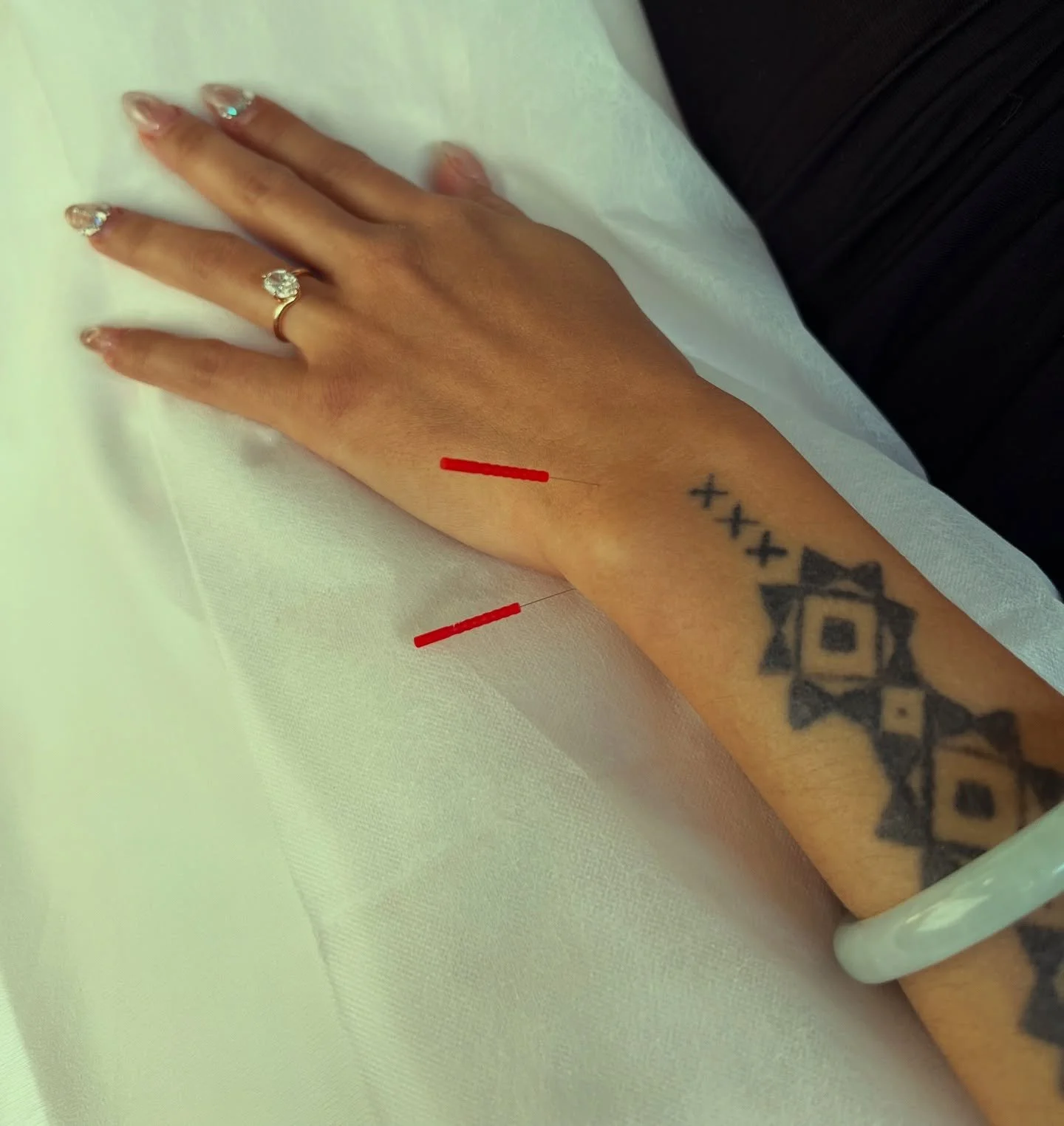 HT 7 and SI 6

SI 6 is a new favorite point of mine. Not only does she help with graceful aging, lifting the neck, and activating the Small Intestine meridian as the Xi cleft point, but she also helps with &ldquo;obsessive thoughts,&rdquo; by helping