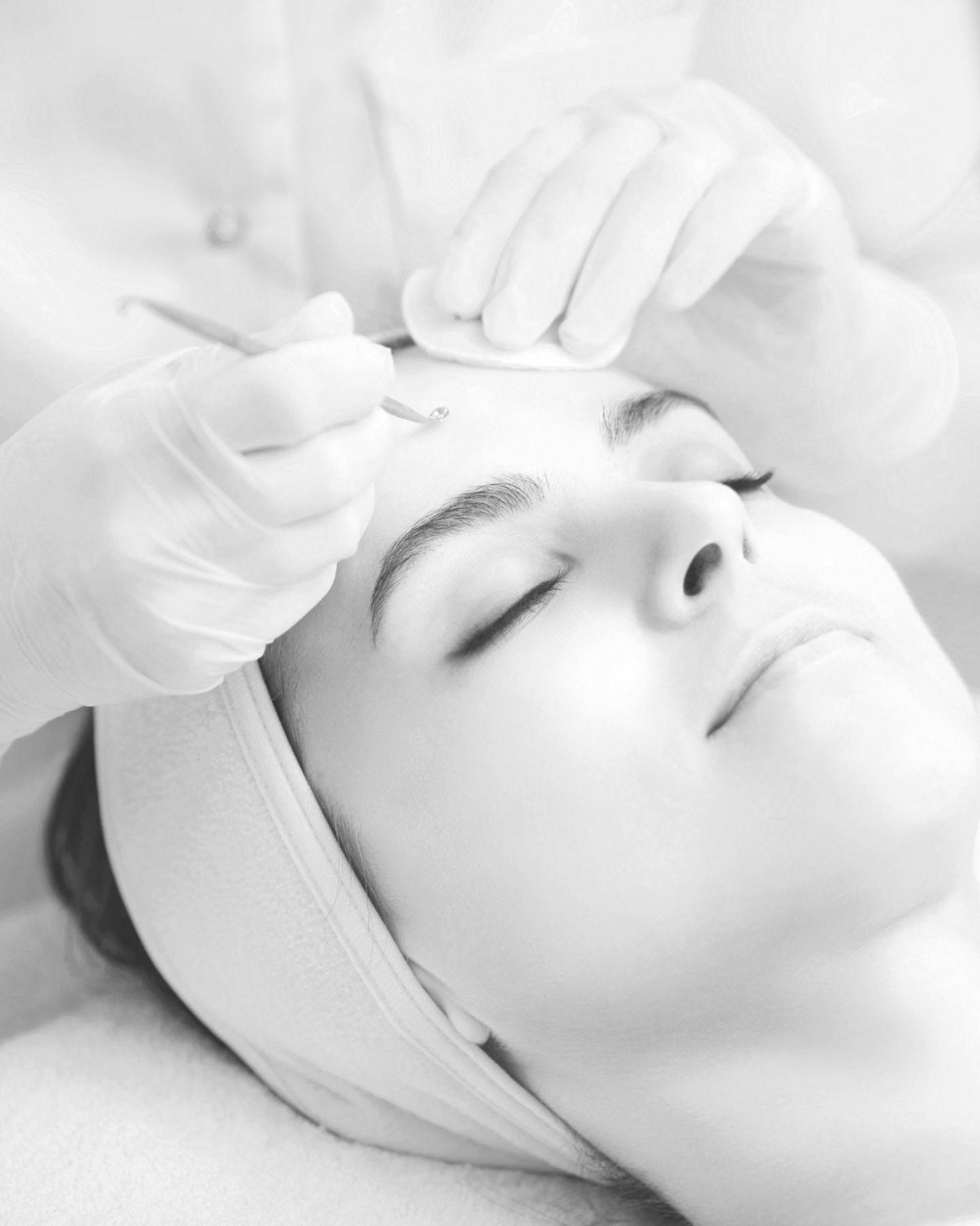 BRIGHT + TIGHT (PEEL X SKINPEN® MICRONEEDLING)