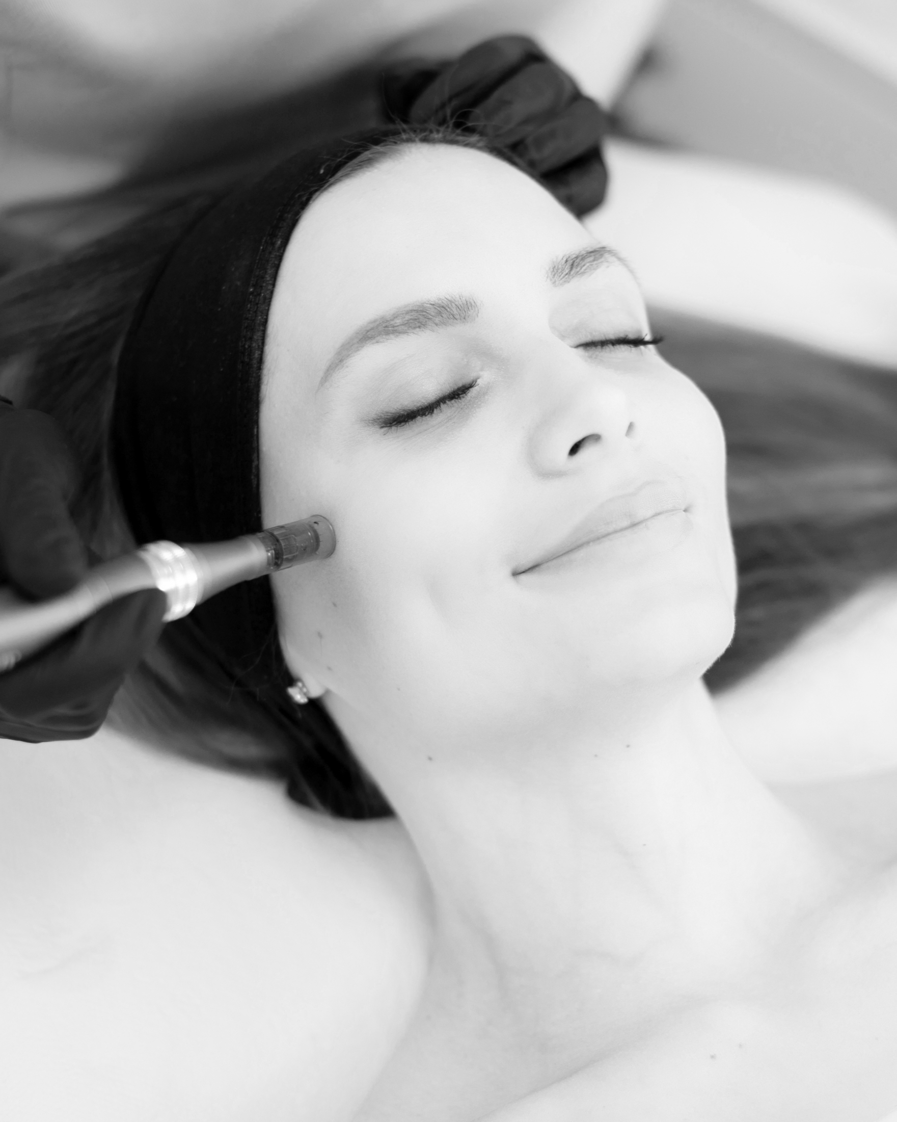 RED CARPET GLOW (DERMAPLANE + CHEMICAL PEEL)