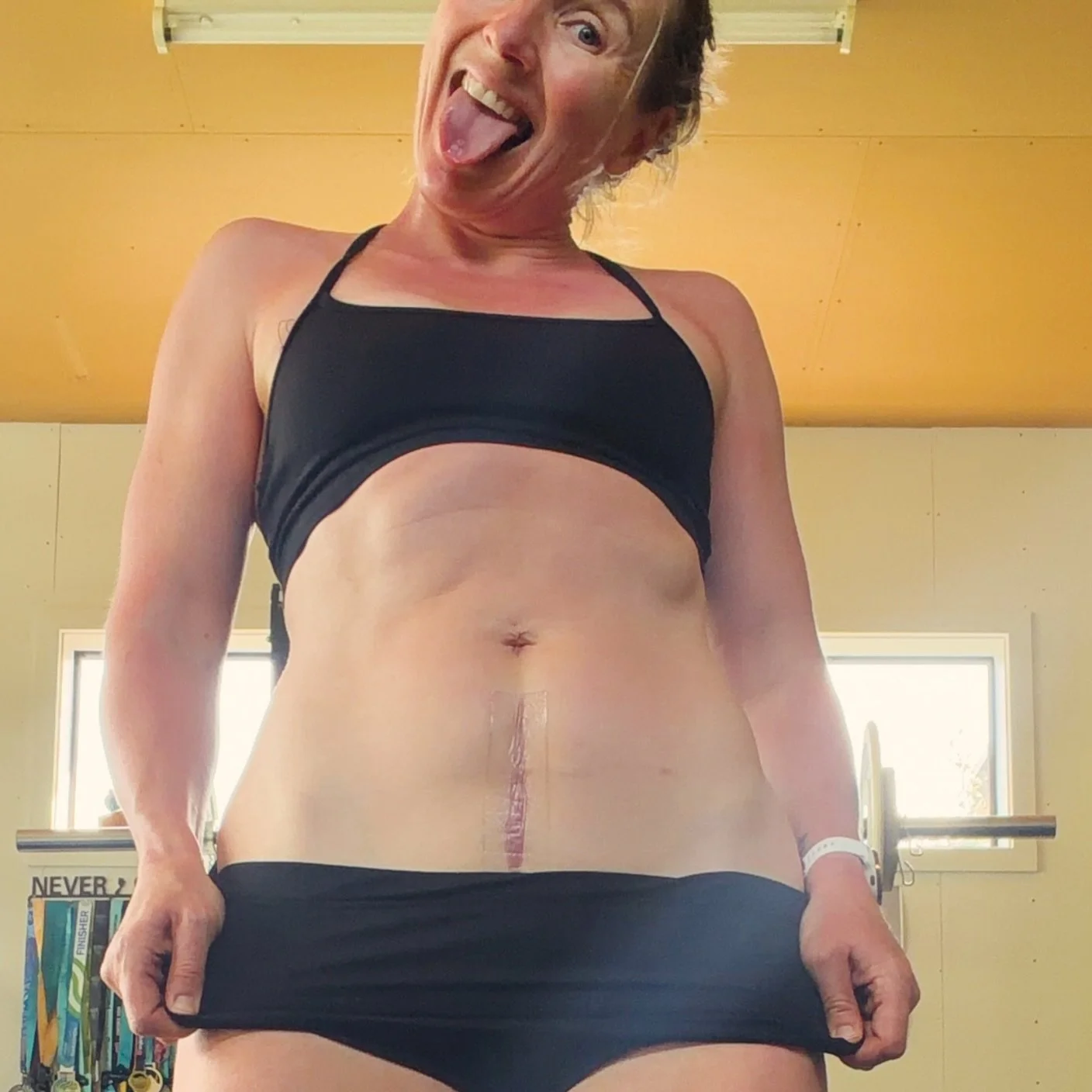 I refuse to hide my scars. I have many! 
I&rsquo;m pretty sure we all do, in some form. Physical, mental, emotional.
They shape us. 
Either into the person we&rsquo;re meant to be, or a person living a life we really don&rsquo;t want to be.

I&rsquo;