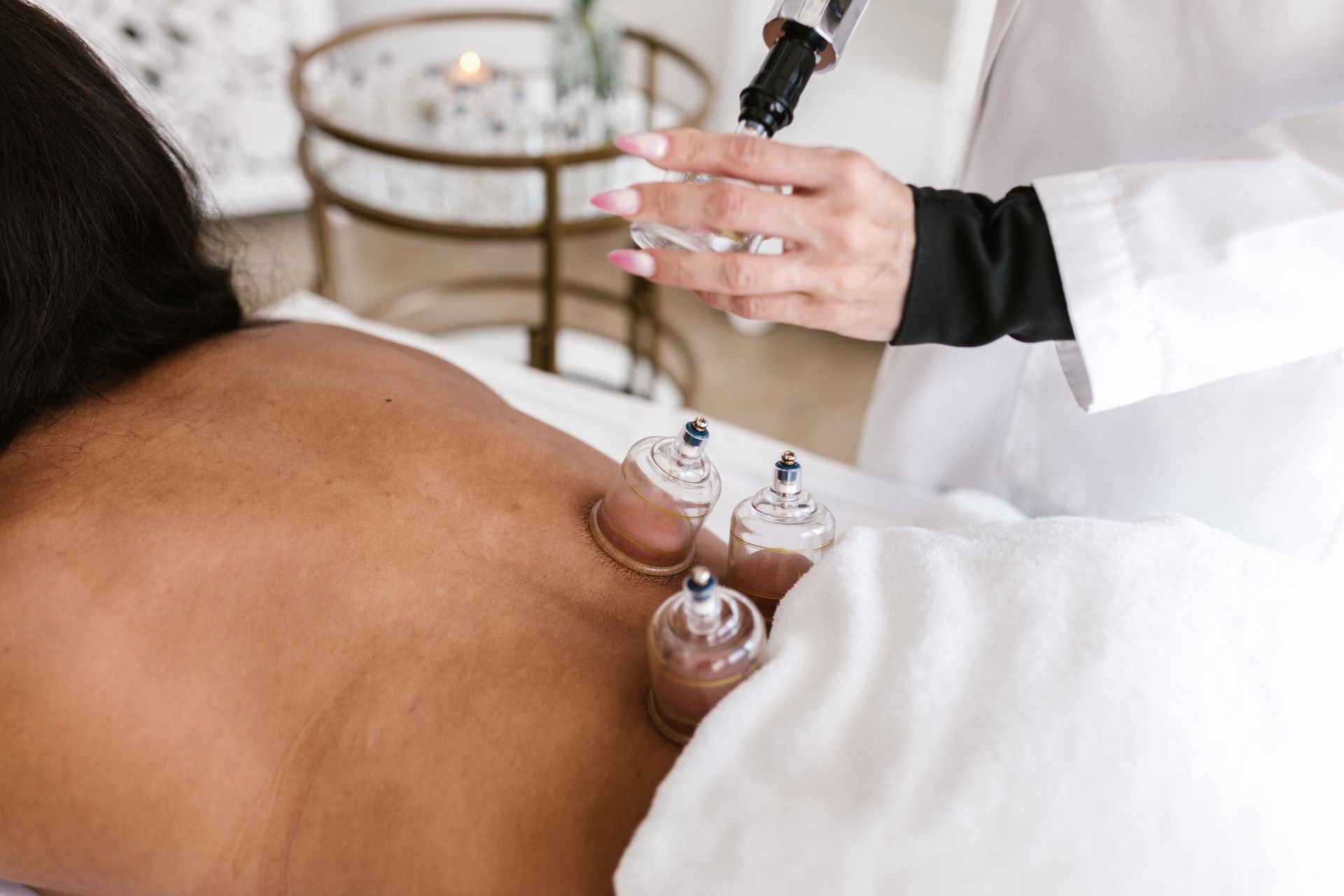 Glass cups placed along a patient's back during cupping therapy