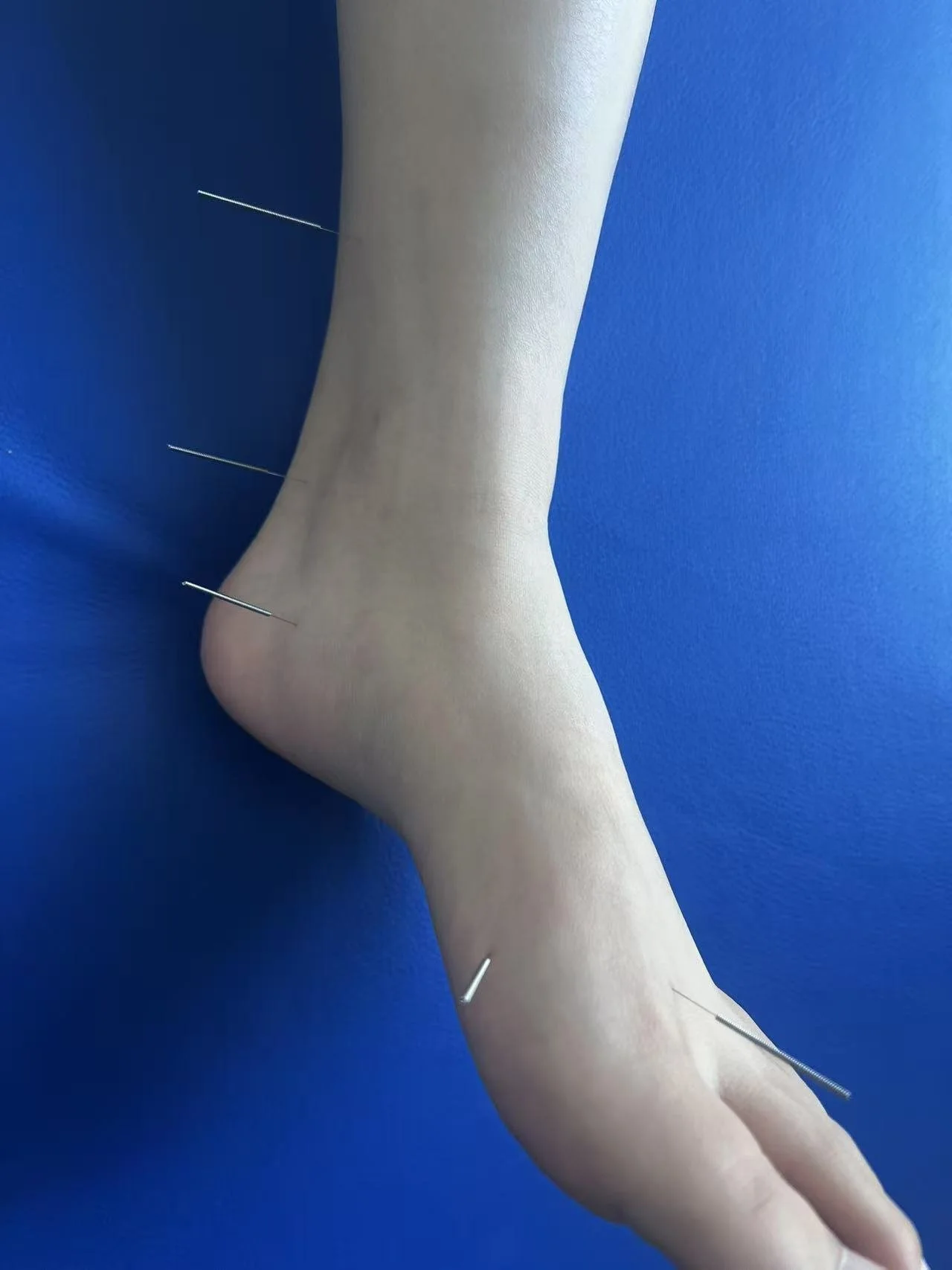 A foot with acupuncture needles inserted at various points against a blue background.
