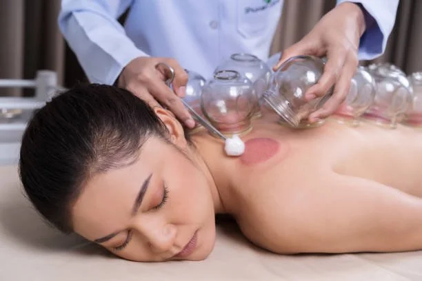 Fire Cupping vs Dry Cupping