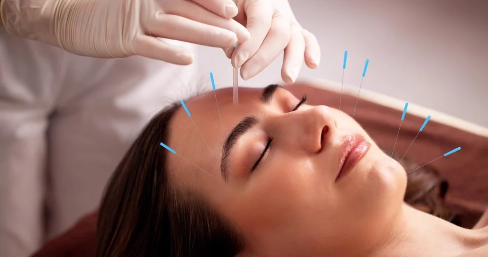 How to Tell If Acupuncture Is Working