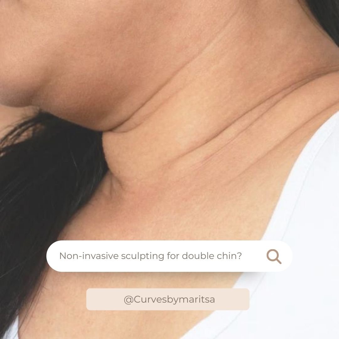 Copy of Cavitation Insta Posts Nude Template .jpg