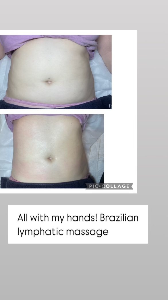 Brazilian Lymphatic.jpg