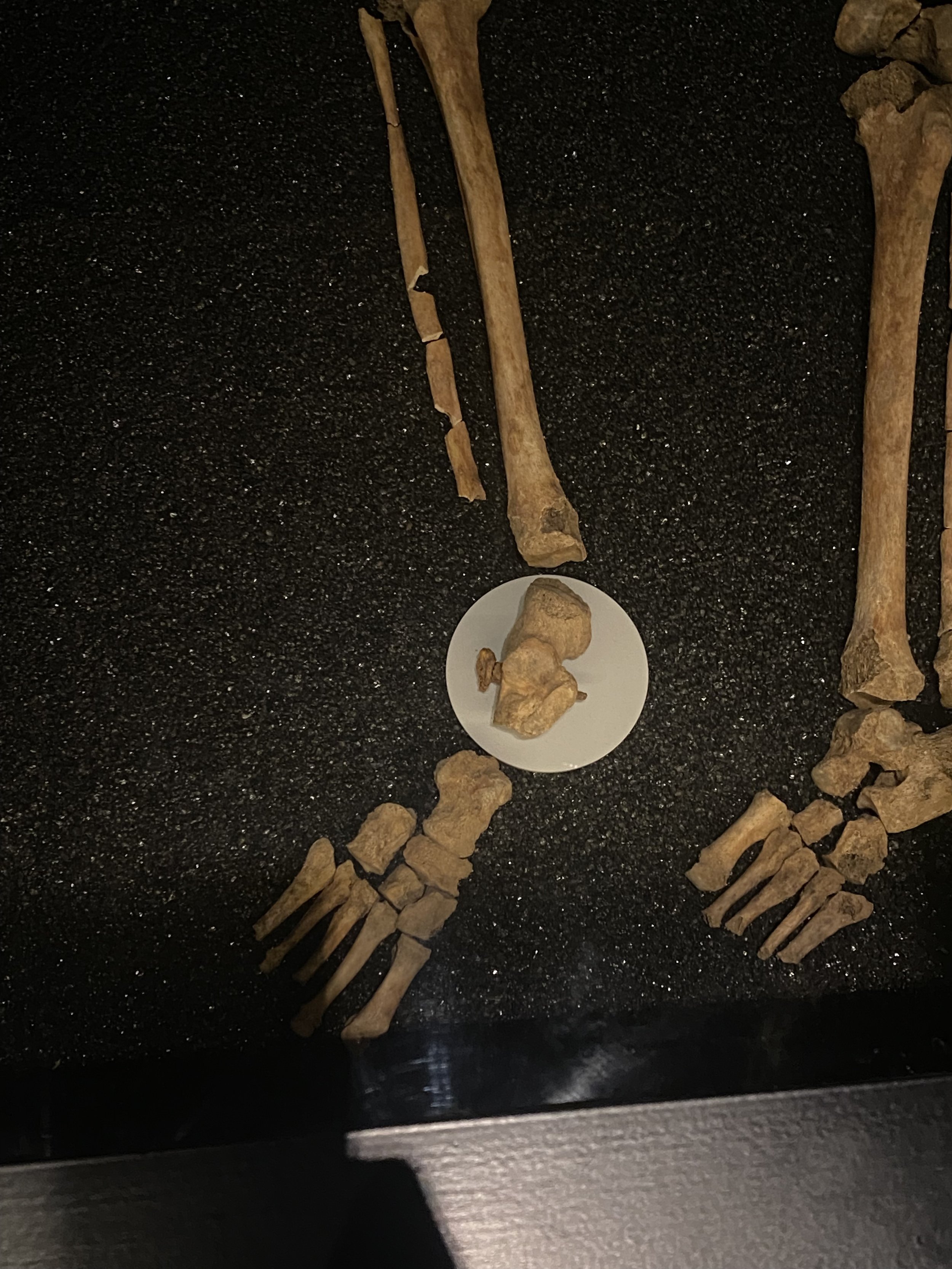 Skeleton Ankle.jpg