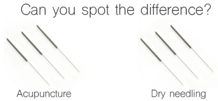 Acupuncture vs. Dry Needling