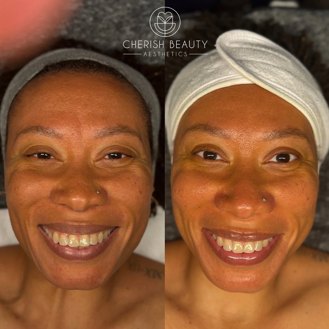 Luxury Facial in Waco