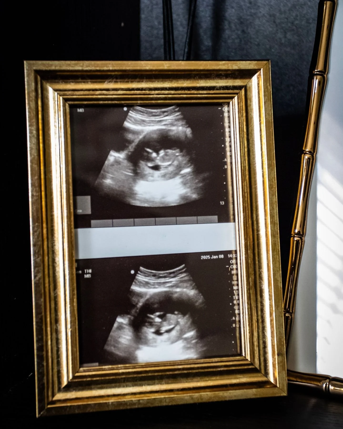 My daughter is now 7 months old, this is a throwback Thursday post lol. 

I have learned so much from her in the past 7 months.

My daughter has zero patience for anything that doesn't immediately make sense to her.

If she's hungry, she wants food n