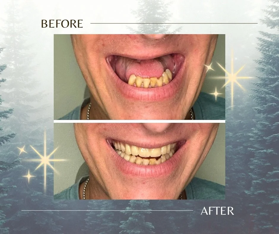 🎉 New Year, New You&hellip; New Smile! 🎉
As we step into 2026, there&rsquo;s no better time for a fresh start. And what better way to kick it off than with a confident, radiant smile? 😁

If one of your New Year&rsquo;s resolutions is to feel great