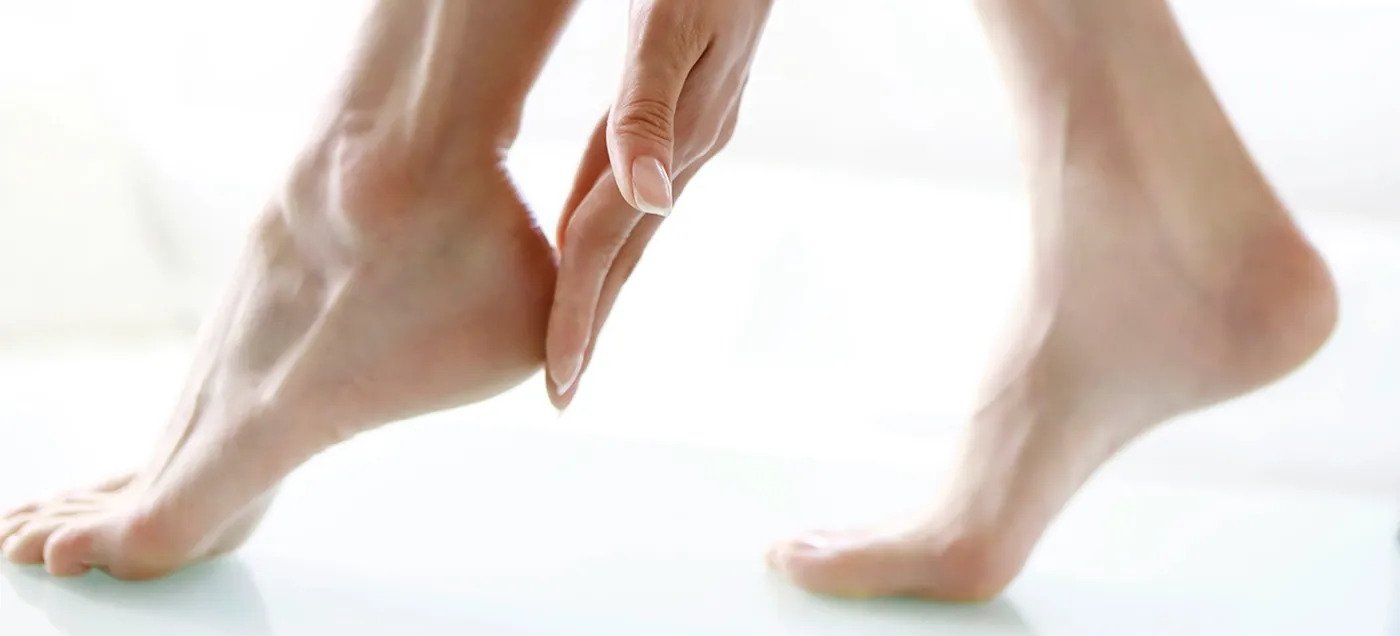 Callus Peel