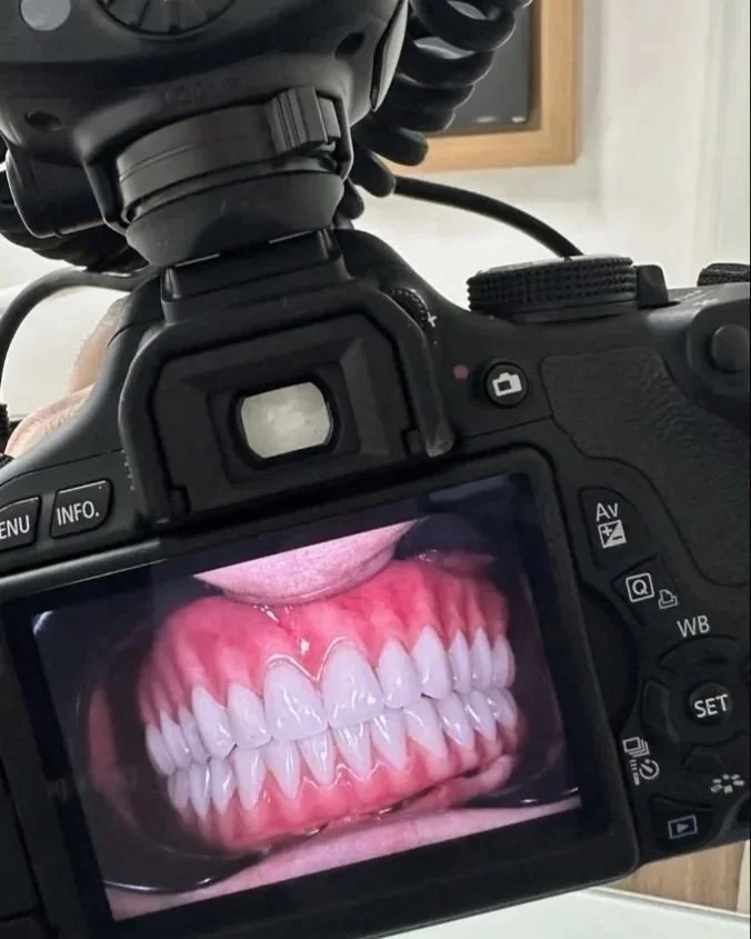 fotocamera digitale che mostra un'immagine di denti umani con gengive rosa e denti bianchi.