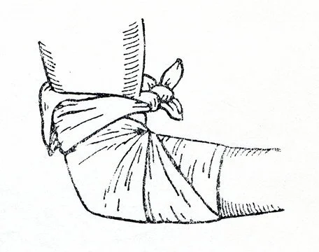 The Hobbit, Chapter 18: Arm Sling