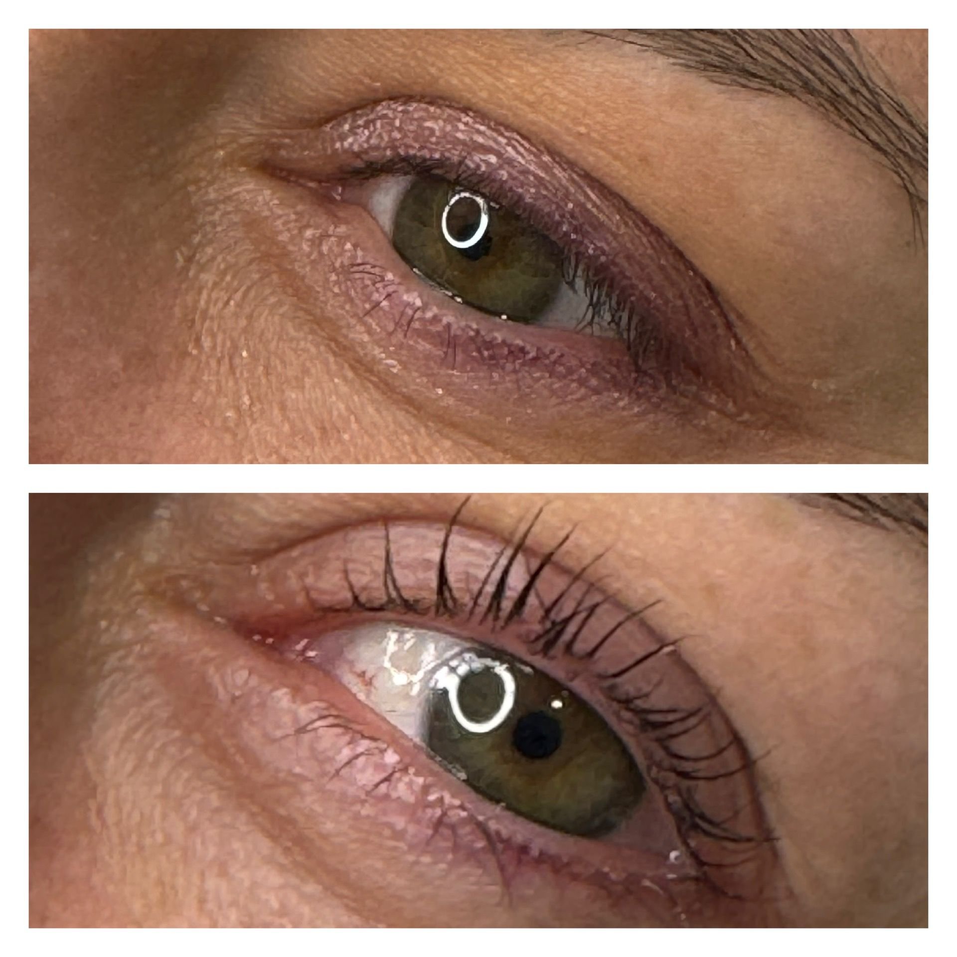 Rehaussement de sourcils