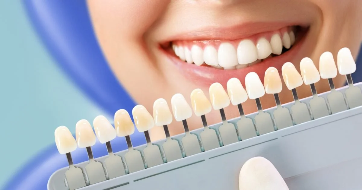 Some of the different methods for whitening teeth can be found here.