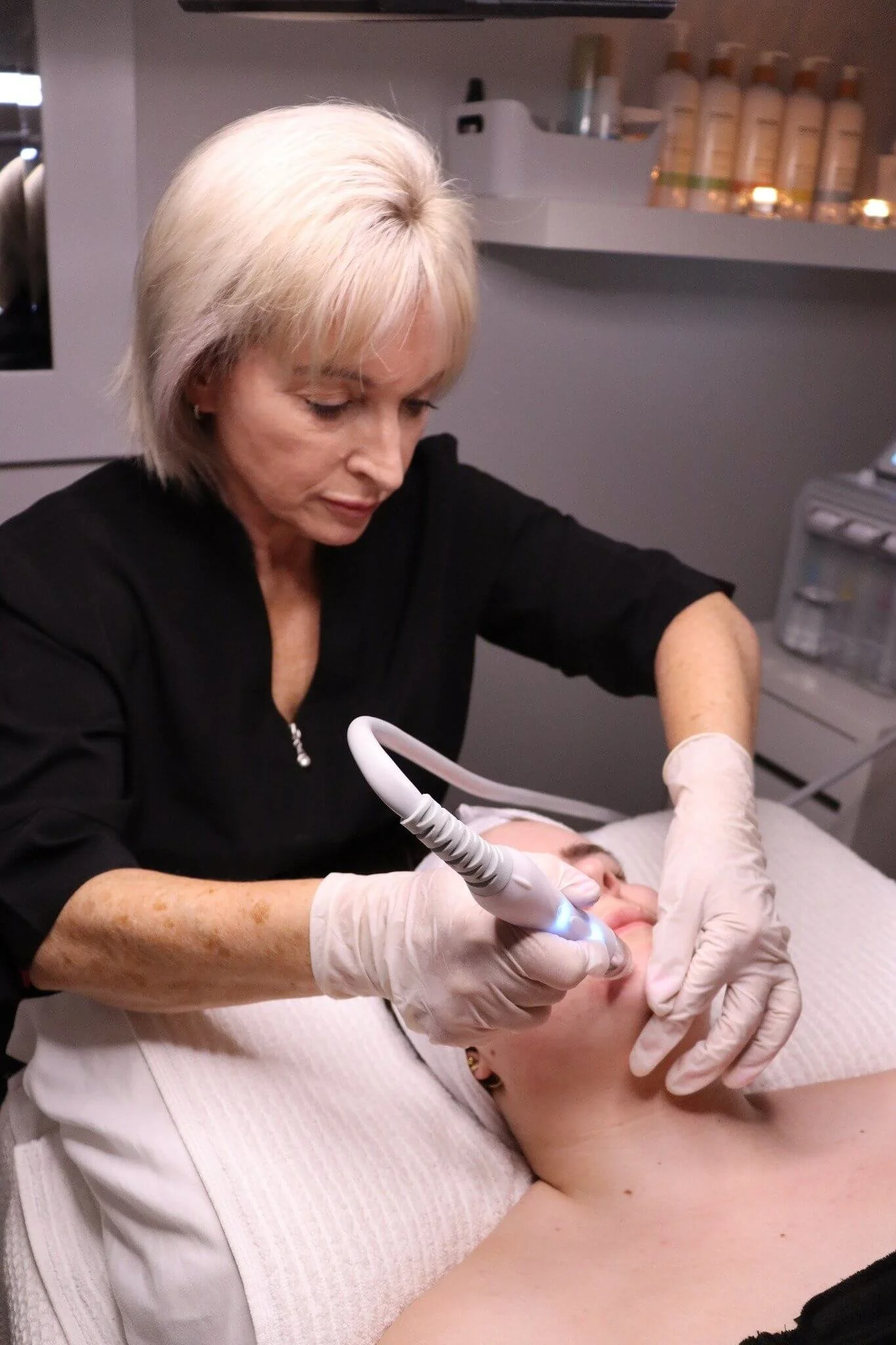 patient having microdermabrasion treatment by Kim