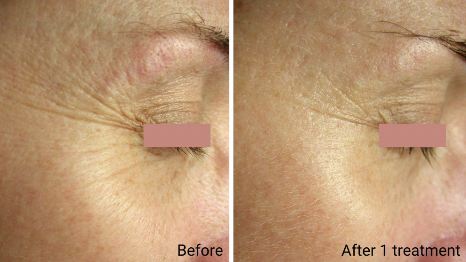 COLLAGEN 90+