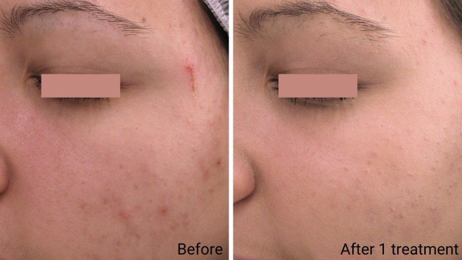 OXYGENATING SKIN CARE