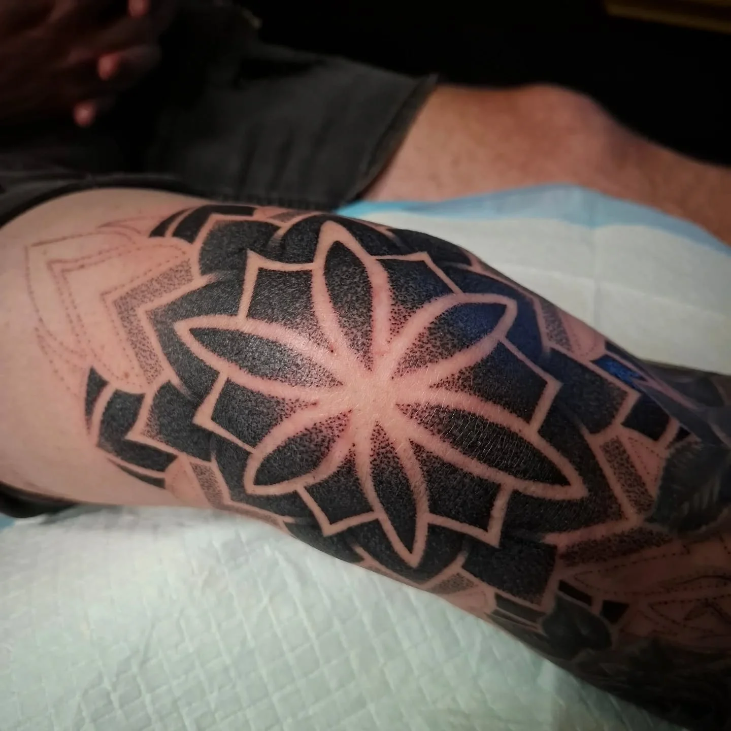 They don&rsquo;t call them knee bangers for nothing. 🔨
Chris sat like a statue for this one! Not a single complaint through one of the toughest spots on the body. We&rsquo;re in the home stretch now, with just a few hours left to cross the finish li