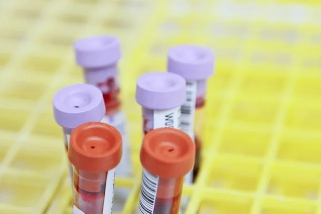 How do functional blood tests differ from standard GP blood tests?