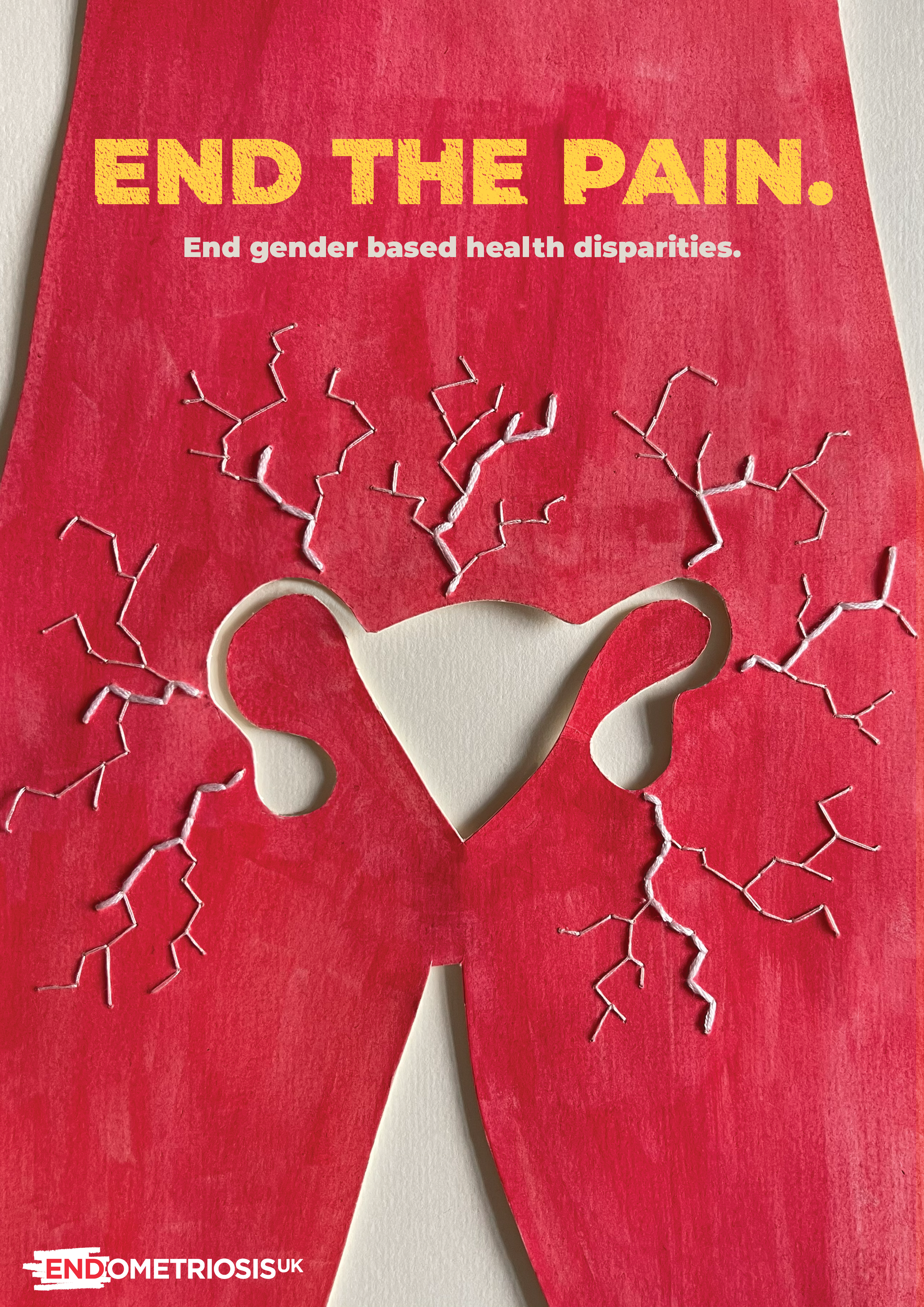 Endometriosis UK