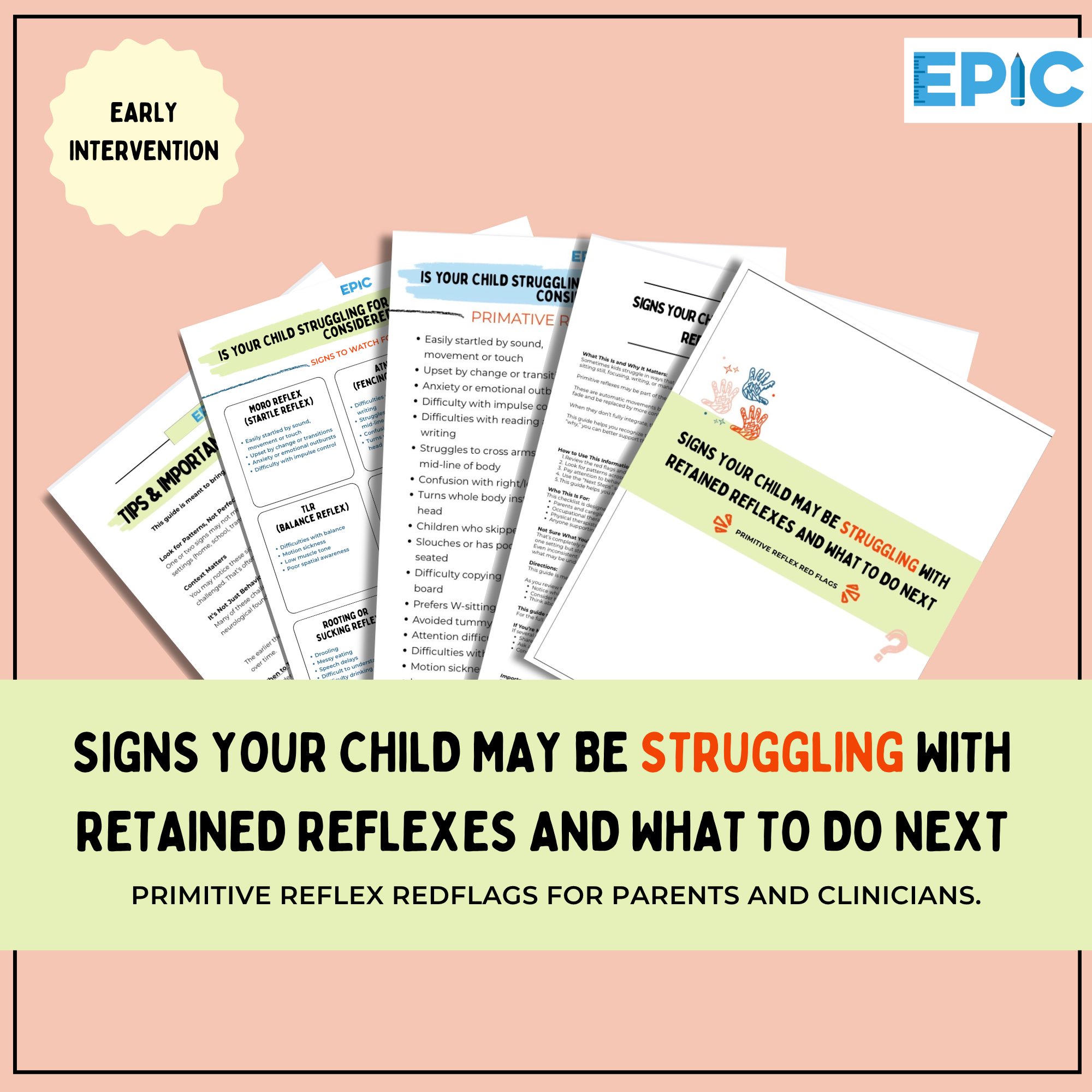 Reflex red flags thumbnail epic.png