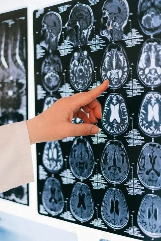 A finger pointing to a brain scan