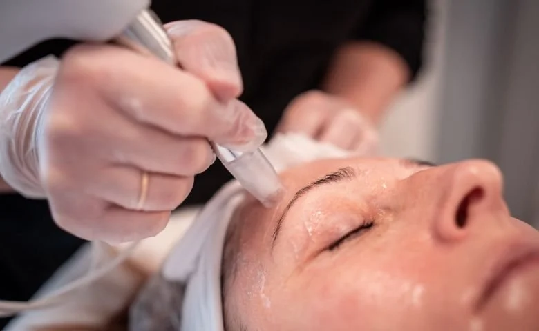 Dermaroller Microneedling