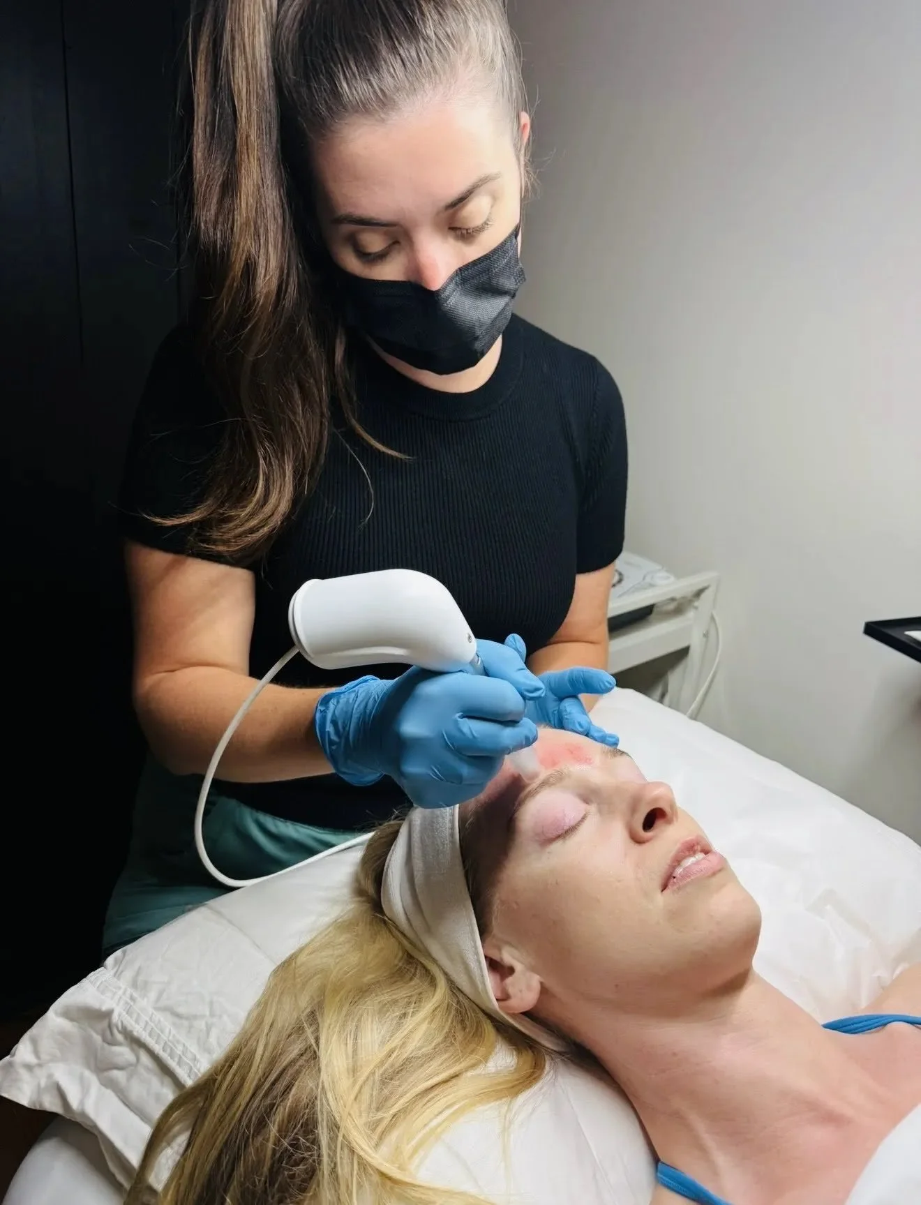 MICRONEEDLING