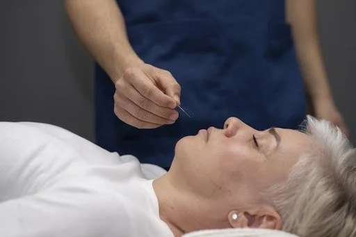 How Acupuncture Transforms the Aging Process for Skin Rejuvenation