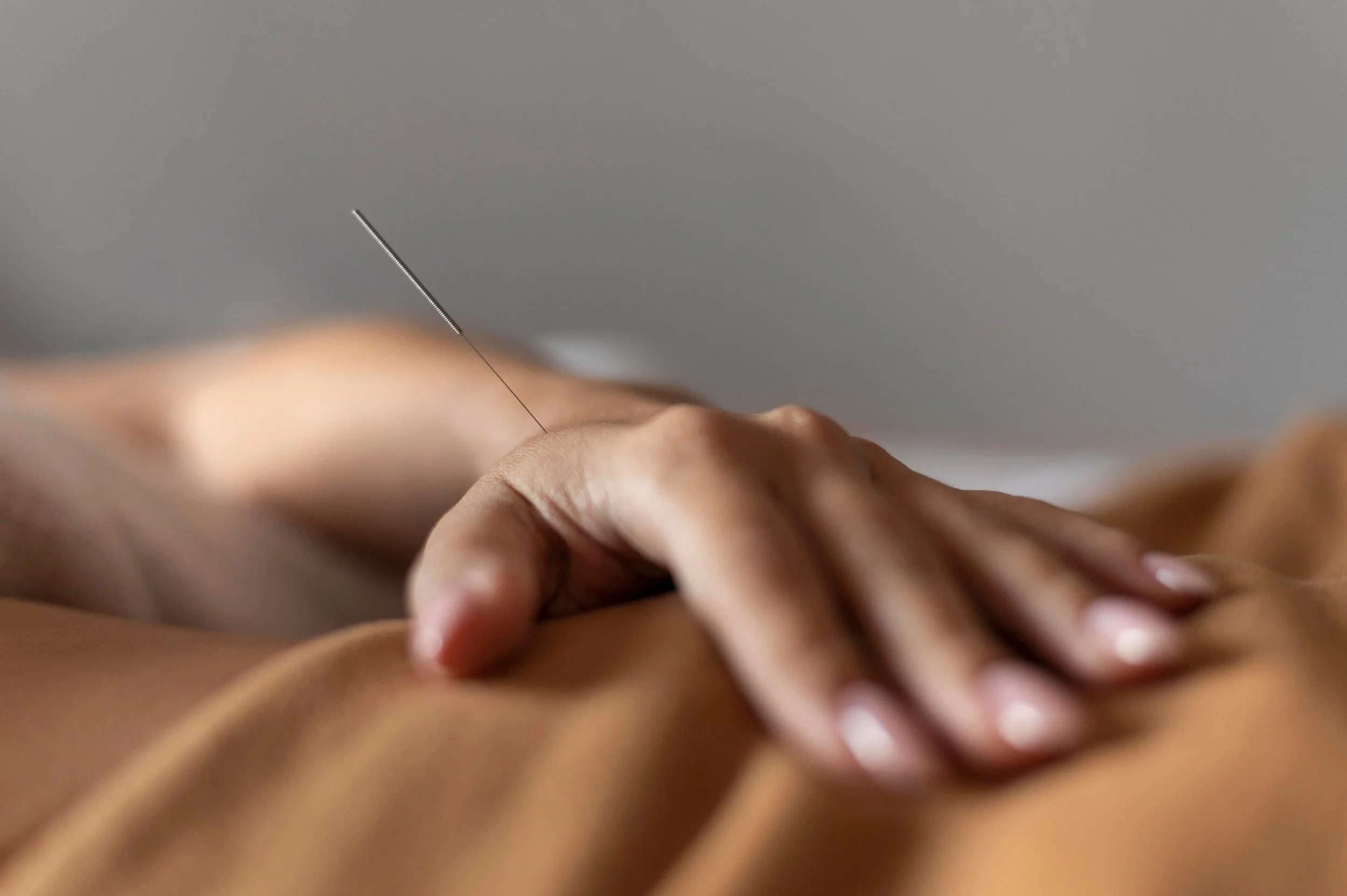 Can Acupuncture Help Support Egg Quality?