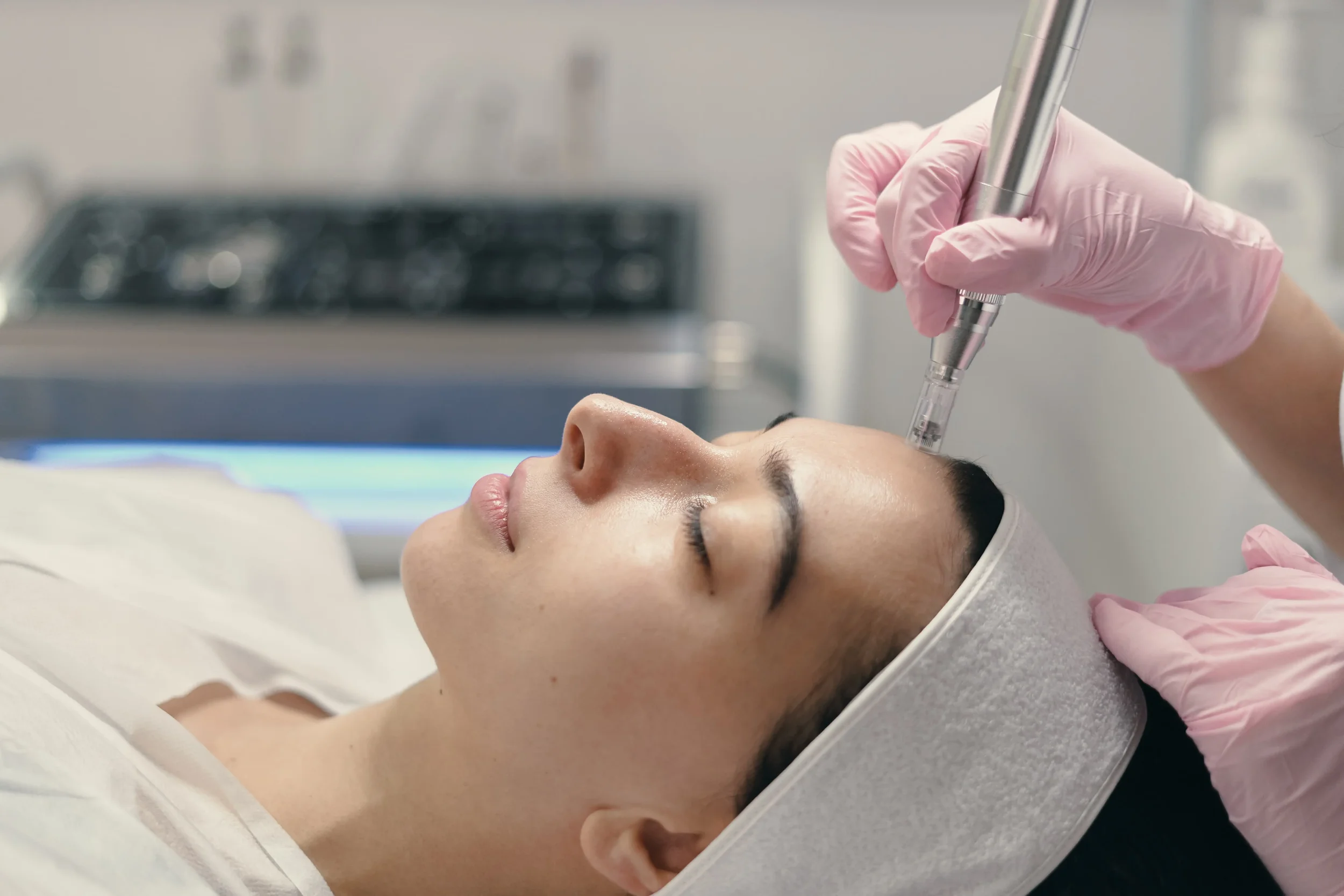 Microneedling Treatment