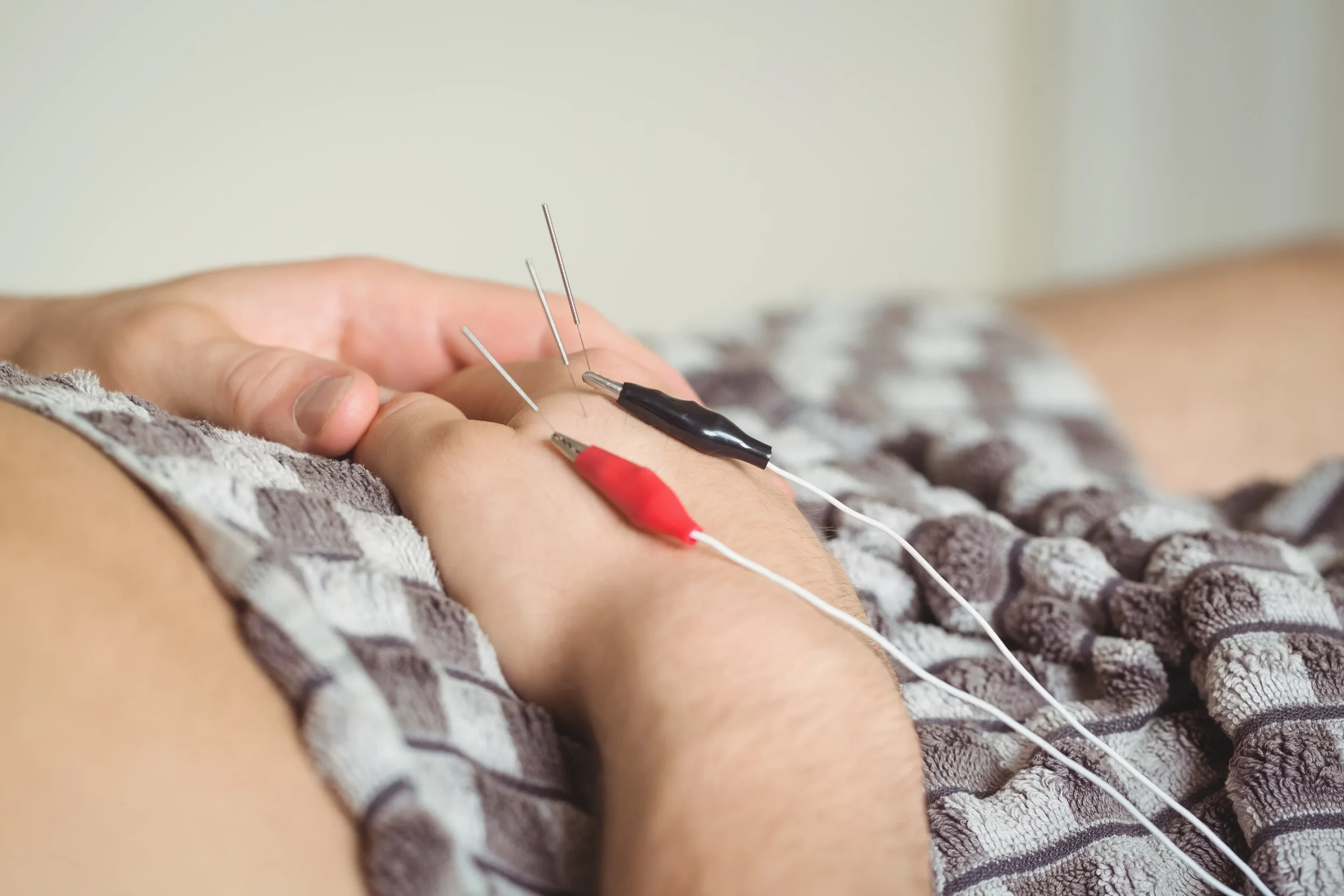 Acupuncture for Fertility