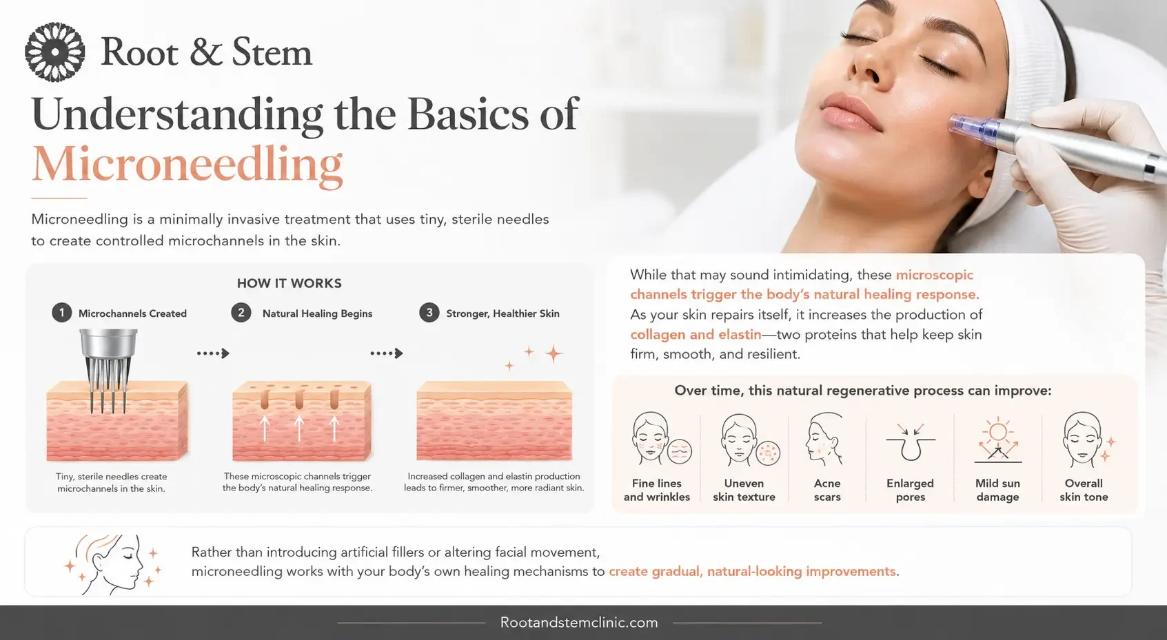 Microneedling