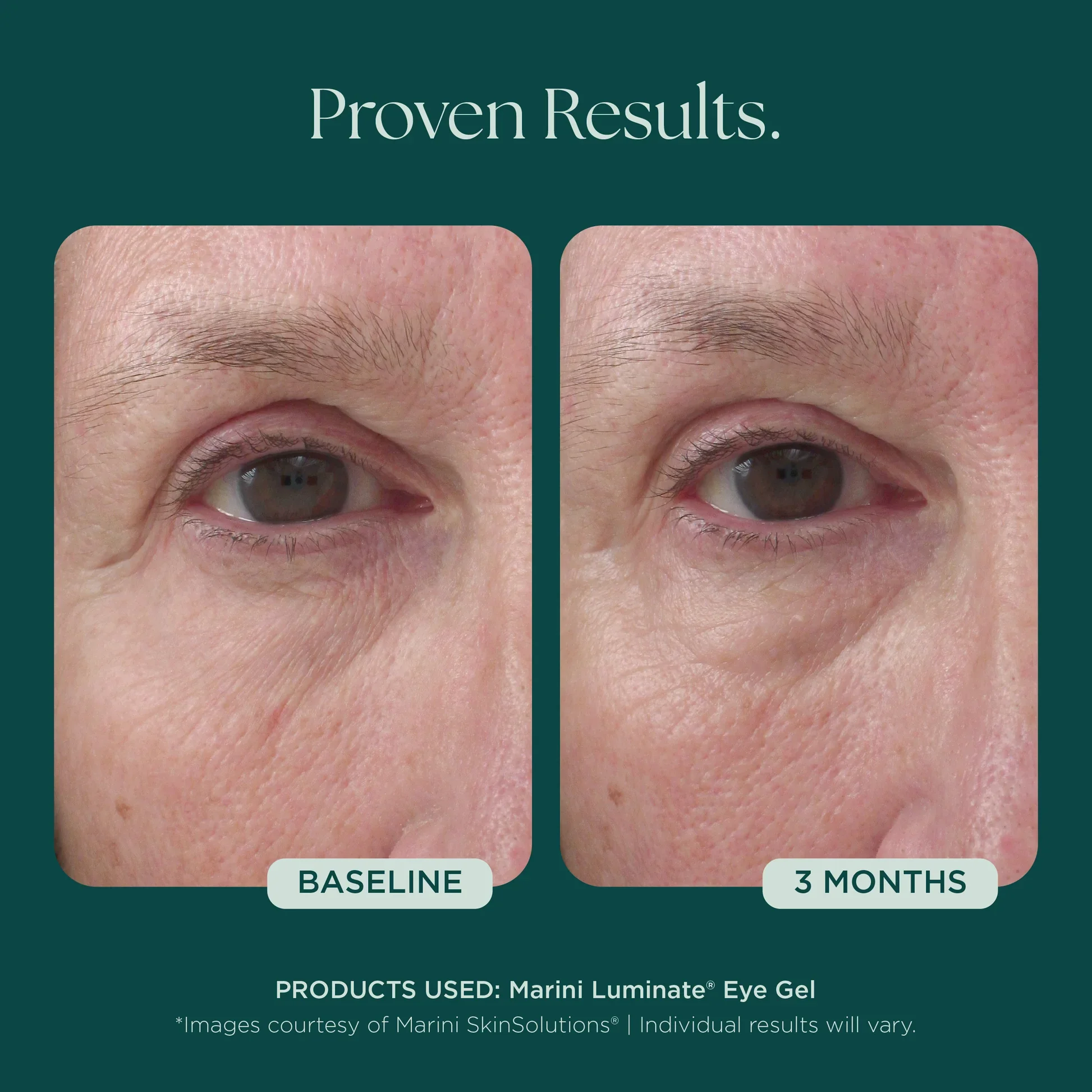 MSS26_Shopify_ProductPage_Before_Afters_042726__EYES-02.jpg.webp