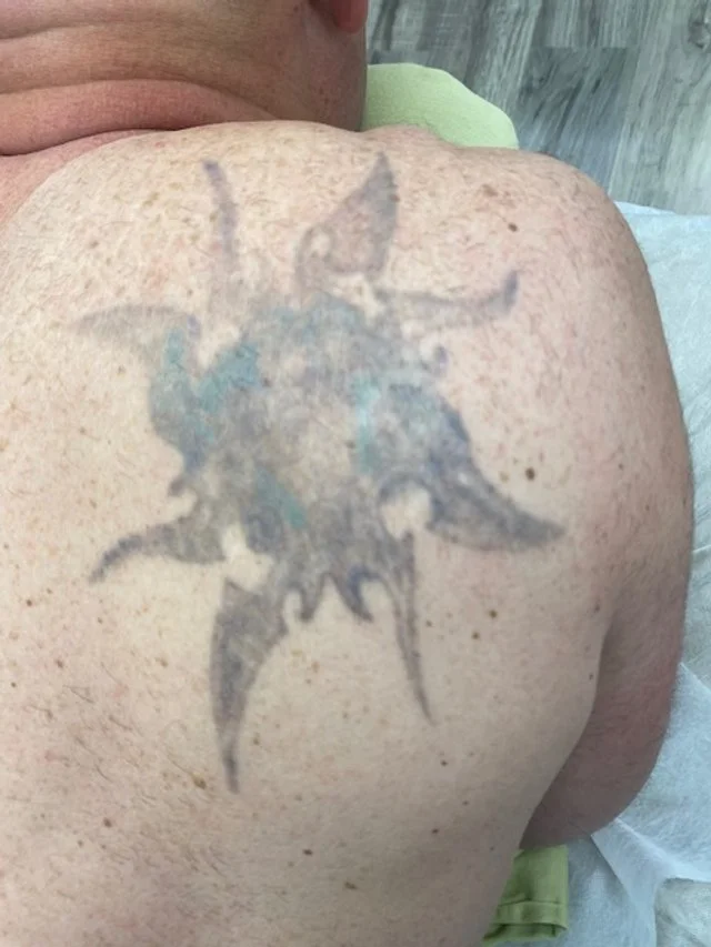 Close-up of a person's shoulder with a tattoo of a stylized, abstract sun or star design.