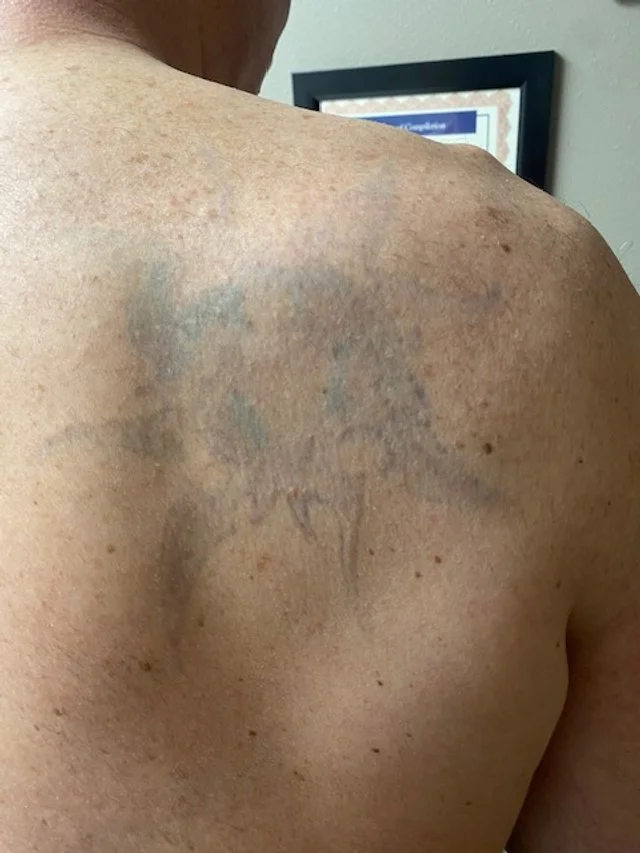 A person's bare shoulder with faded tattoos on upper back, next to a wall with a framed certificate or diploma visible in the background.