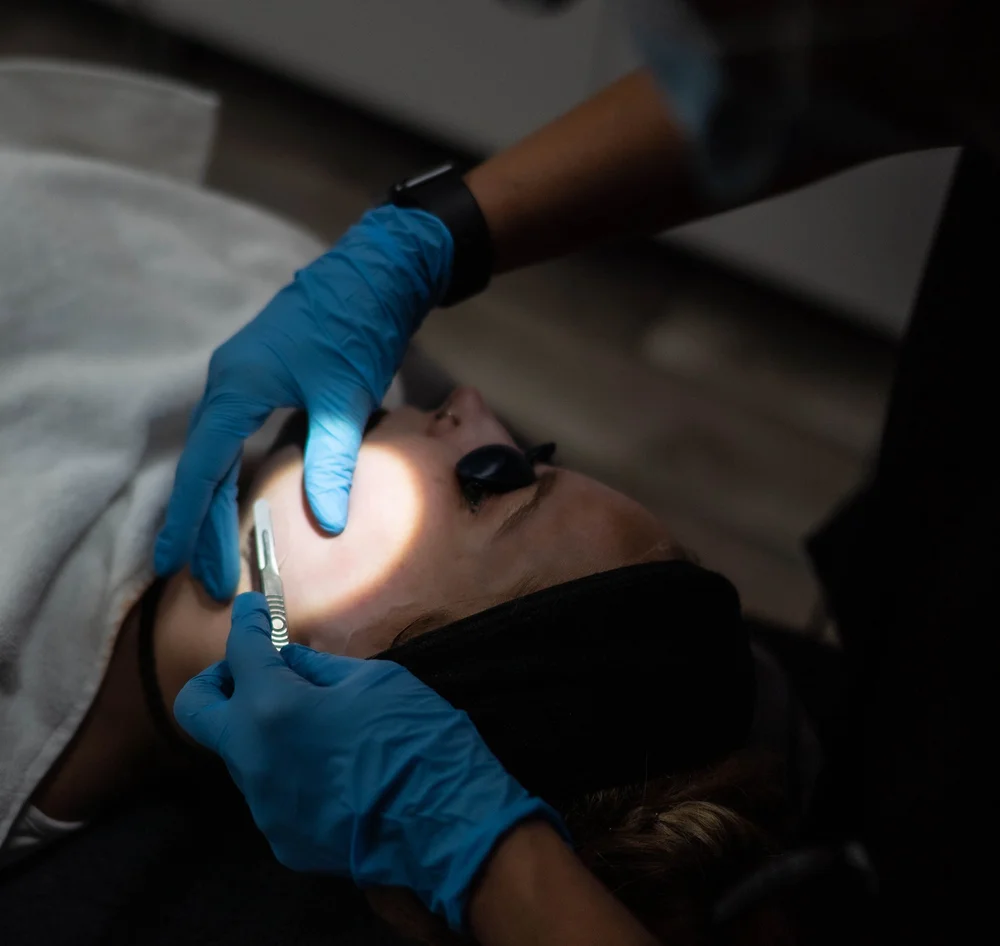 Dermaplaning treatment
