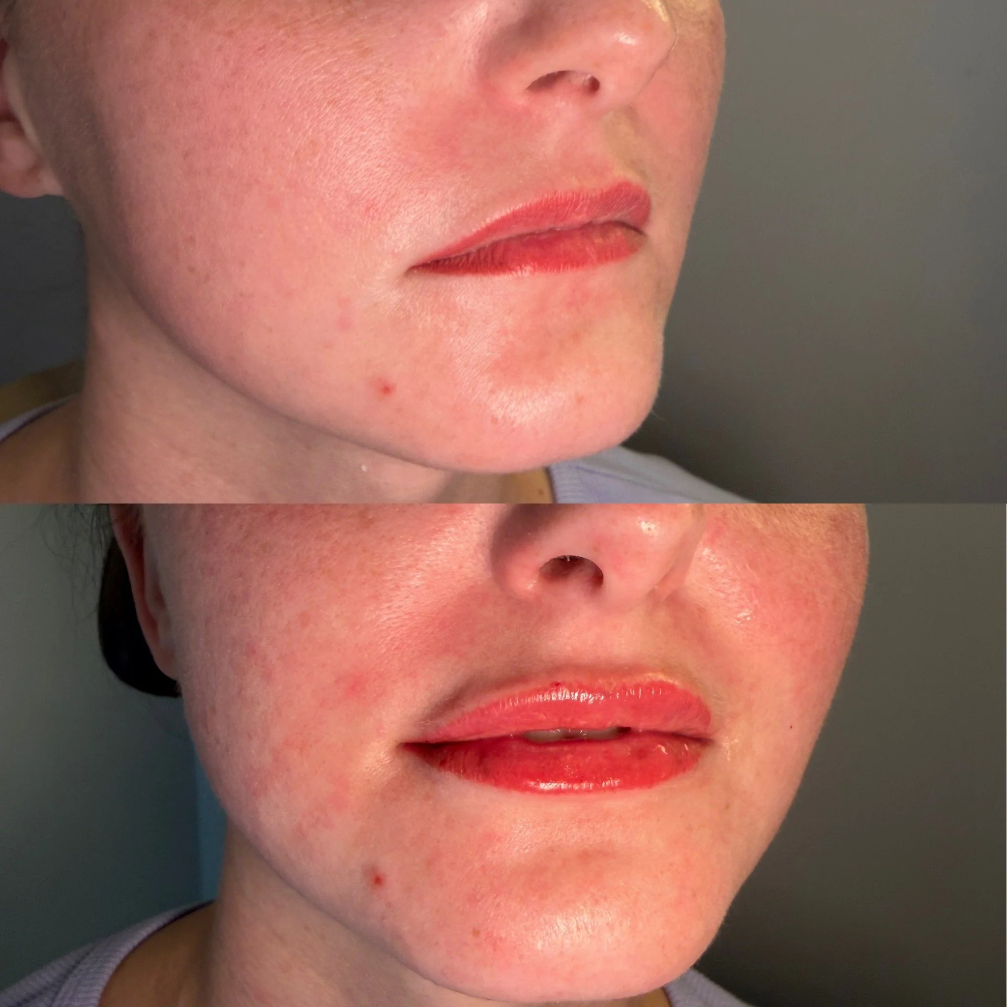 Lip filler looks good on your calendar.

Xoxo,
Ashley💉✨

📞 (850) 276-5161

📍 8317 Front Beach Rd. Unit 34D, Panama City Beach, FL 32407