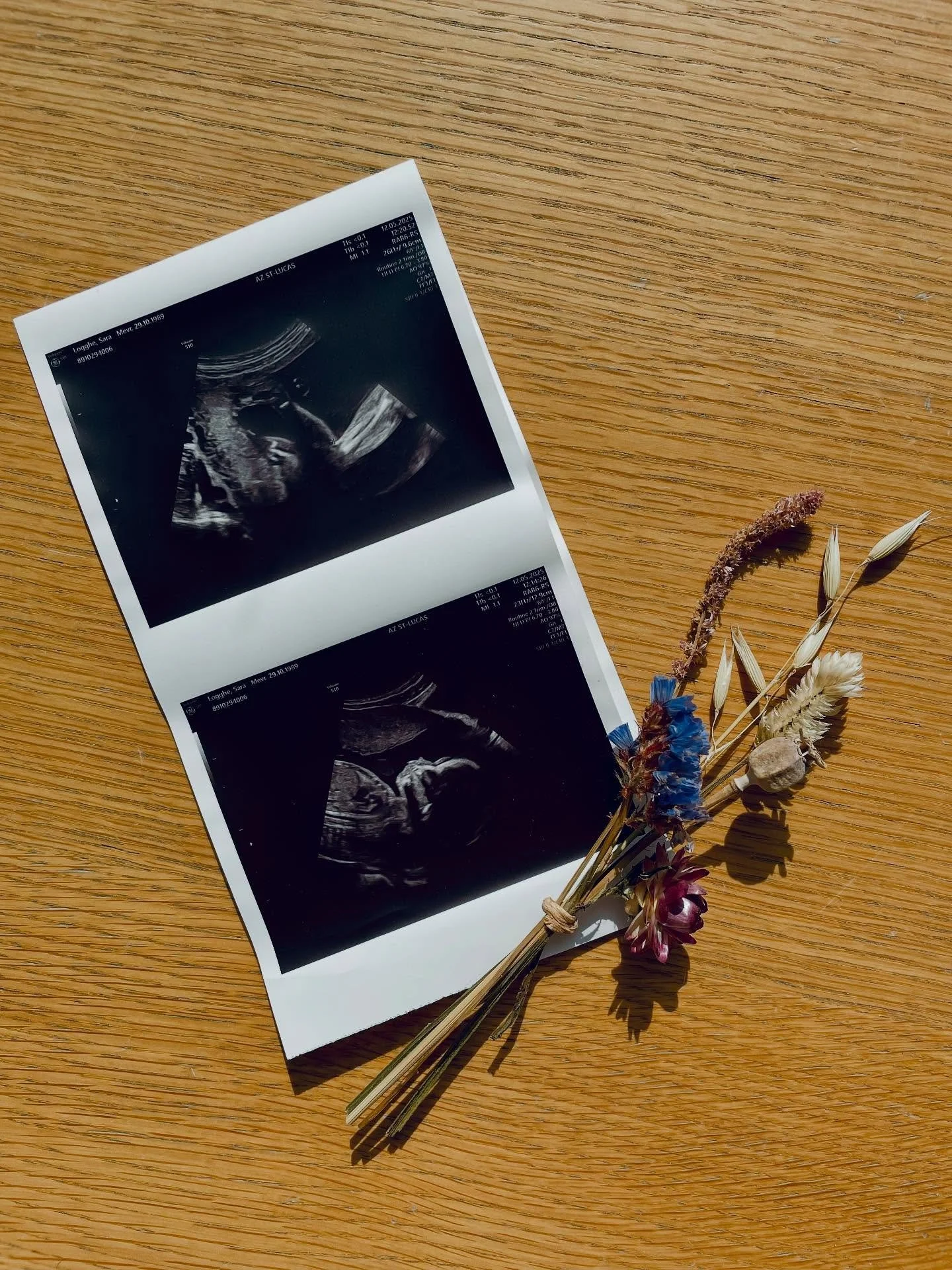 Een derde kind, is het kind zonder fotoalbum. 

Voorlopig klopt dat clich&eacute;, want ik heb nog geen enkele deftige babybuik-foto. Maar wel al deze echo van ons babymeisje 🧡

Ik bouw vanaf nu mijn werk af om in iets meer rust naar de komst van on